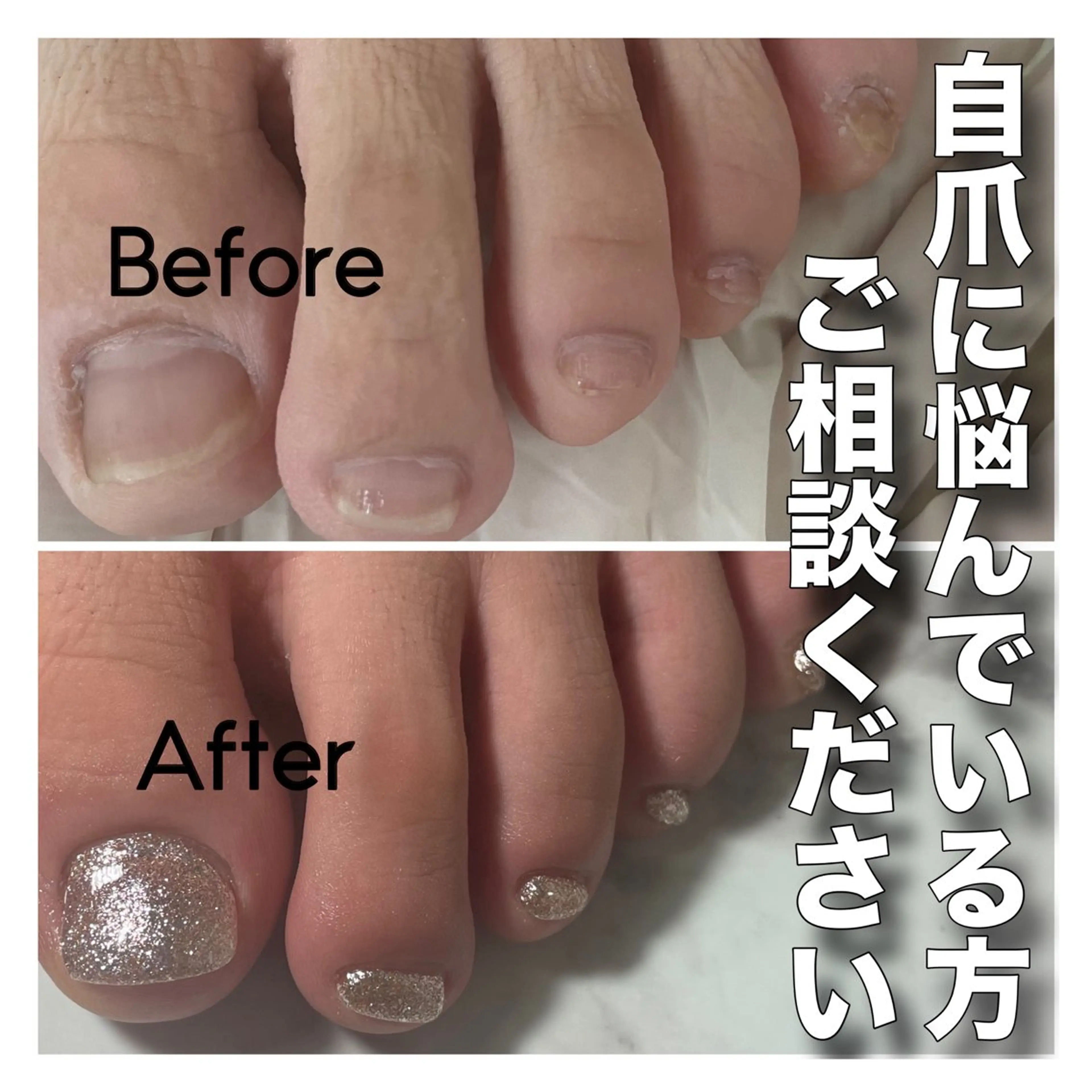 ネイル 長さ出し ジェルネイル フットネイル petillant所属・nail salon petillantのネイルデザイン