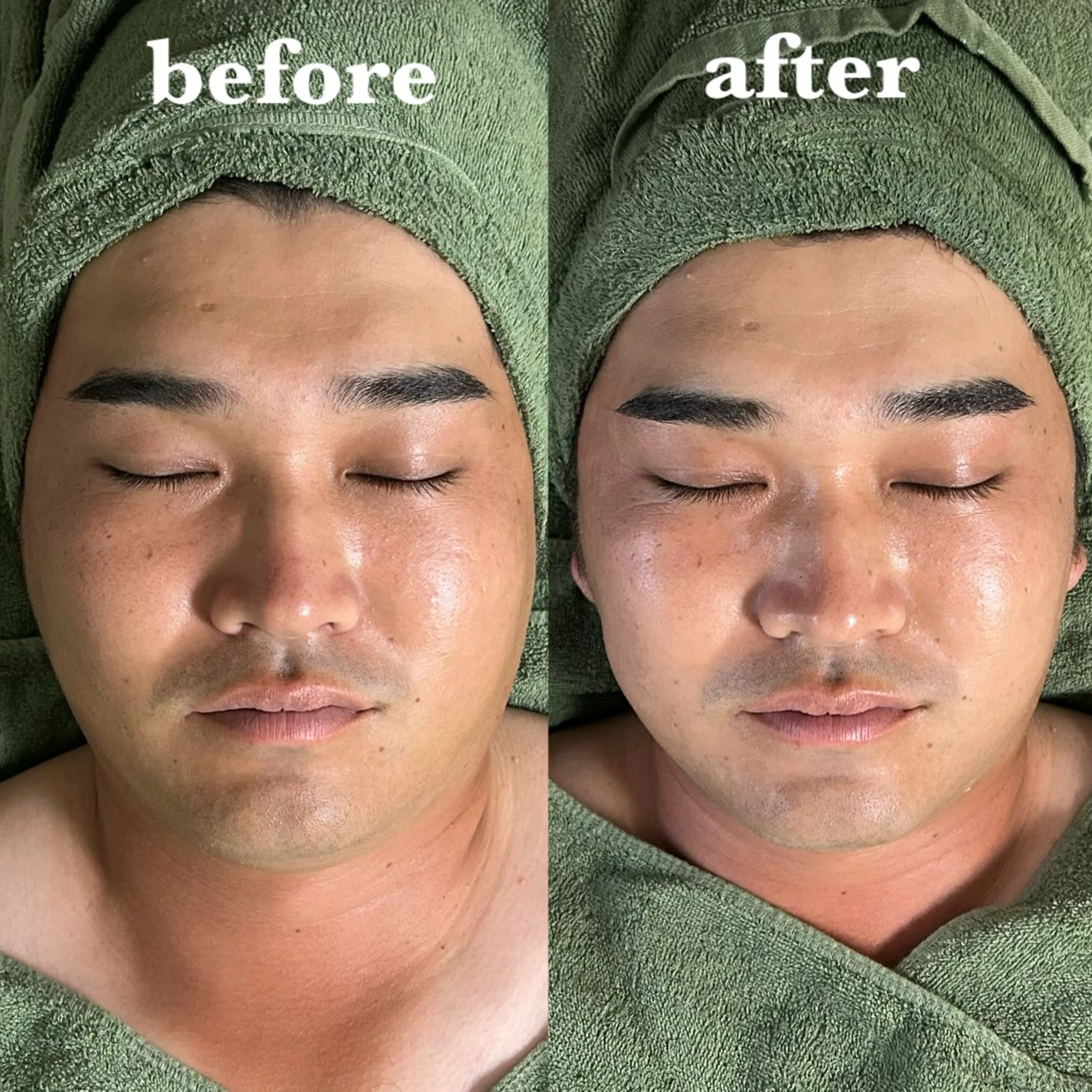 メンズ エステ リラク 【肌質改善サロン】 リーフィアのエステ・リラクイメージ