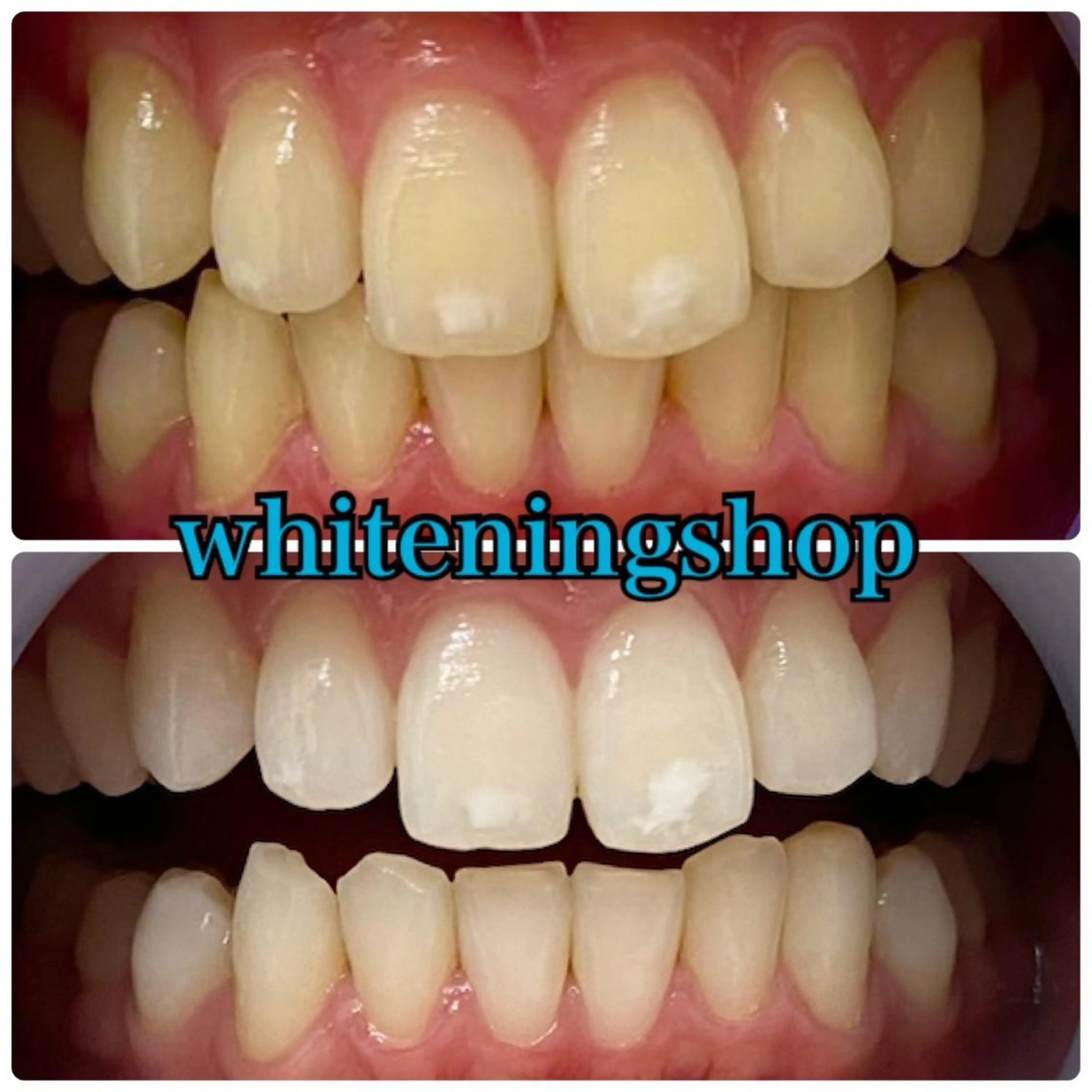 ホワイトニング ショップ吉祥寺店のエステ・リラクイメージ