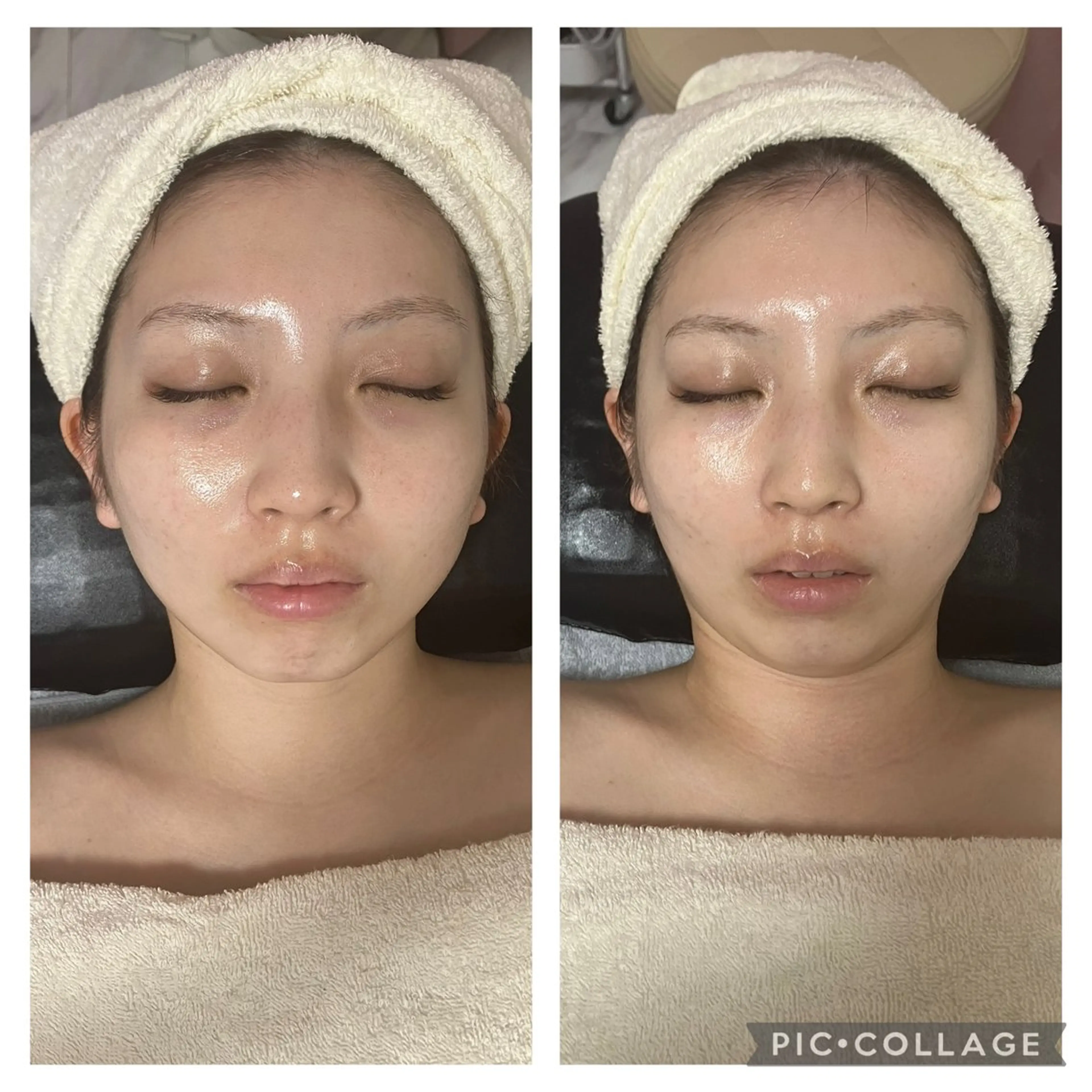 メディカルエステ 痩身·小顔専門サロンBBC 田園調布所属・KEI KOのエステ・リラクイメージ