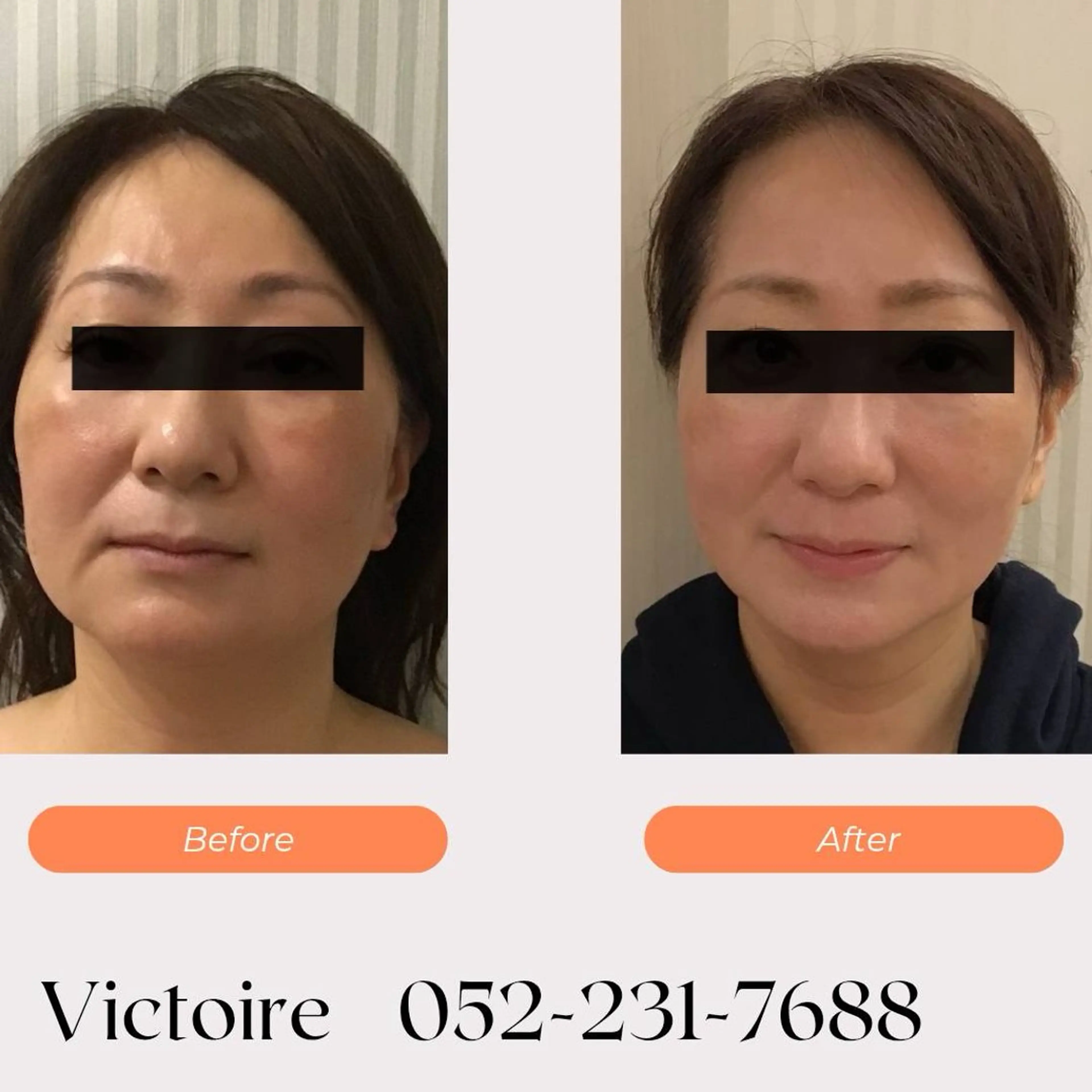 Victoireプチ所属・ヴィクトワール プチのエステ・リラクイメージ