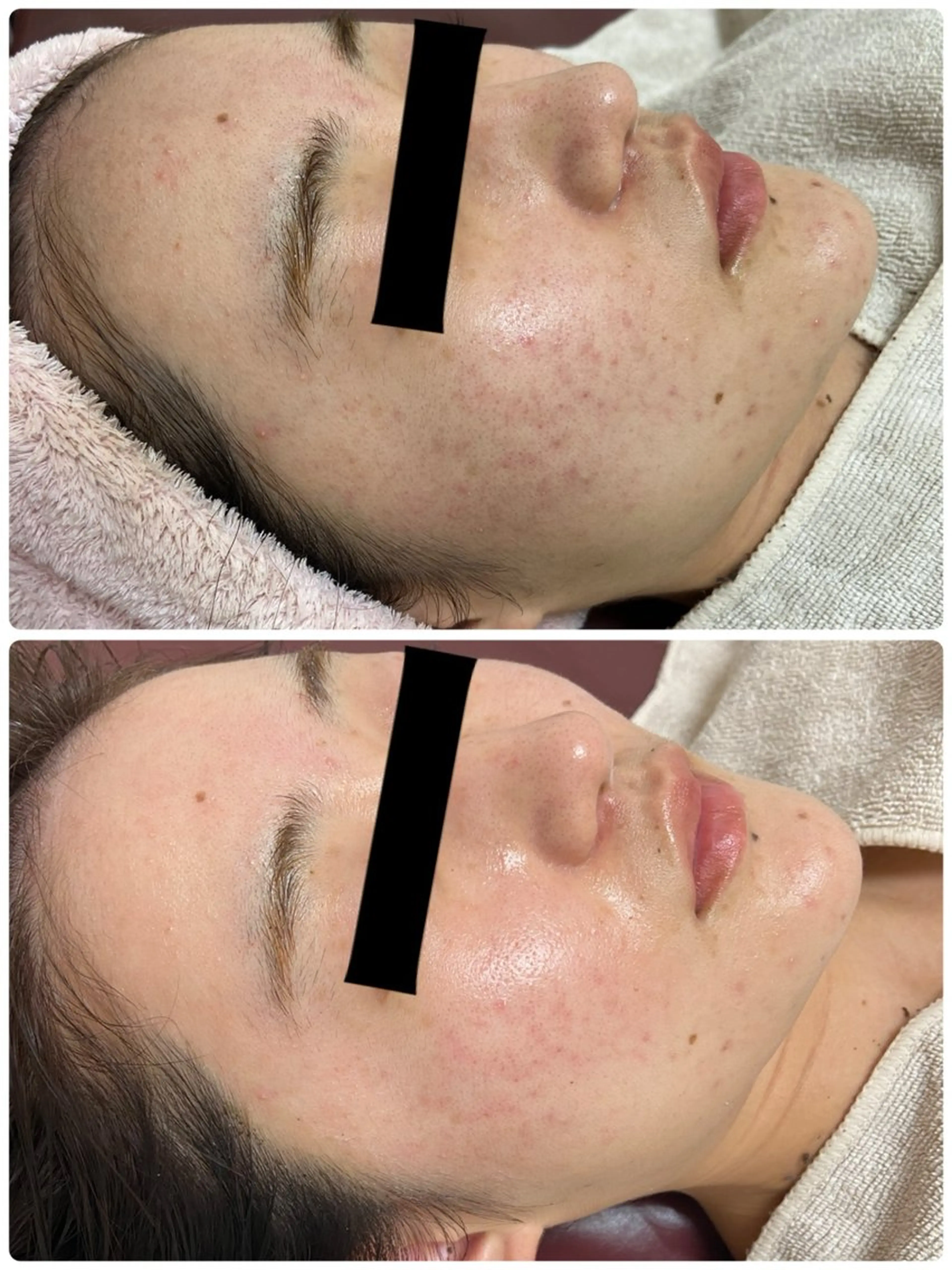 エステ REBORN by ami-goのその他イメージ