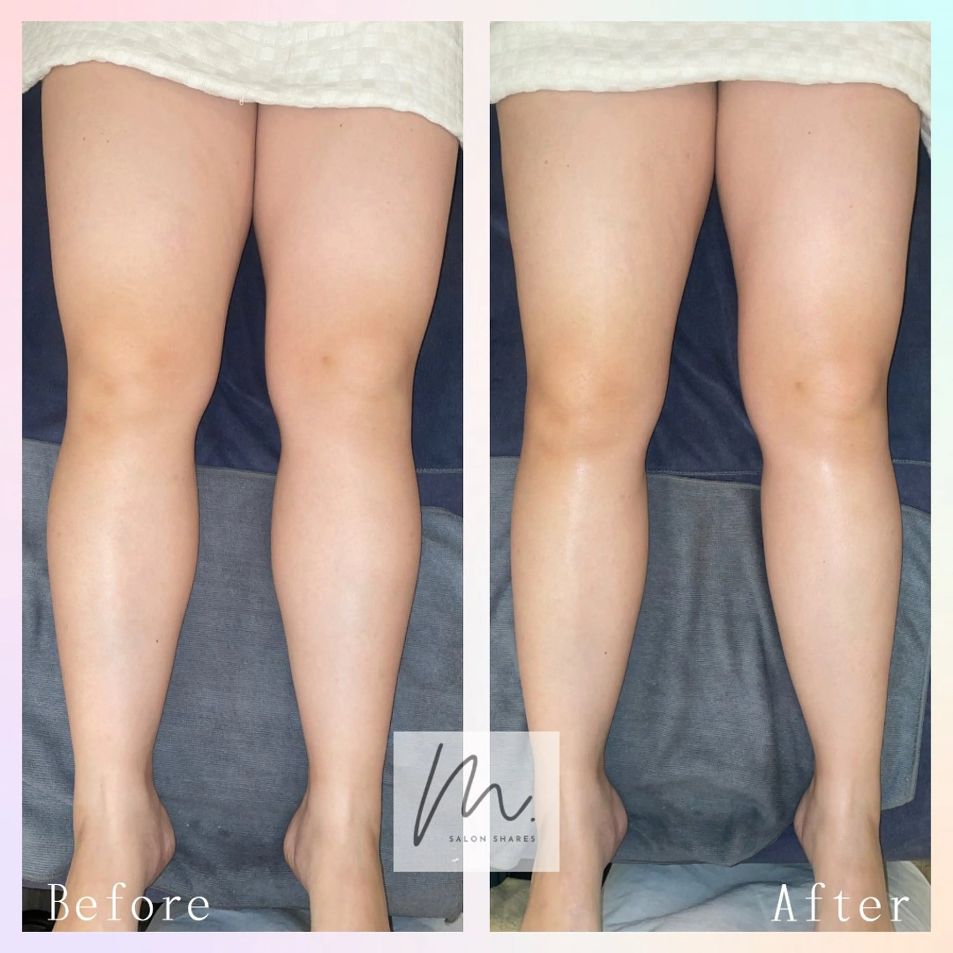 SHARES MADOKAのエステ・リラクイメージ