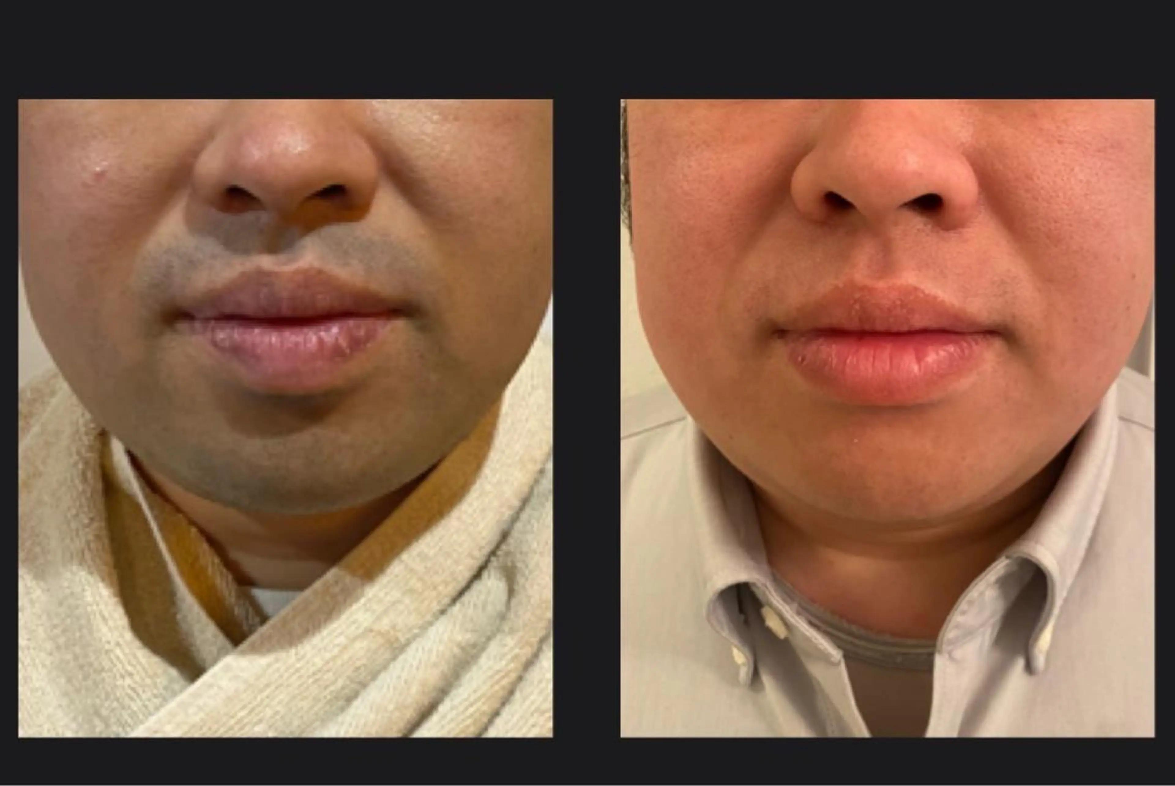 メンズ I'iris所属・【脱毛サロン iiris】占い可のエステ・リラクイメージ