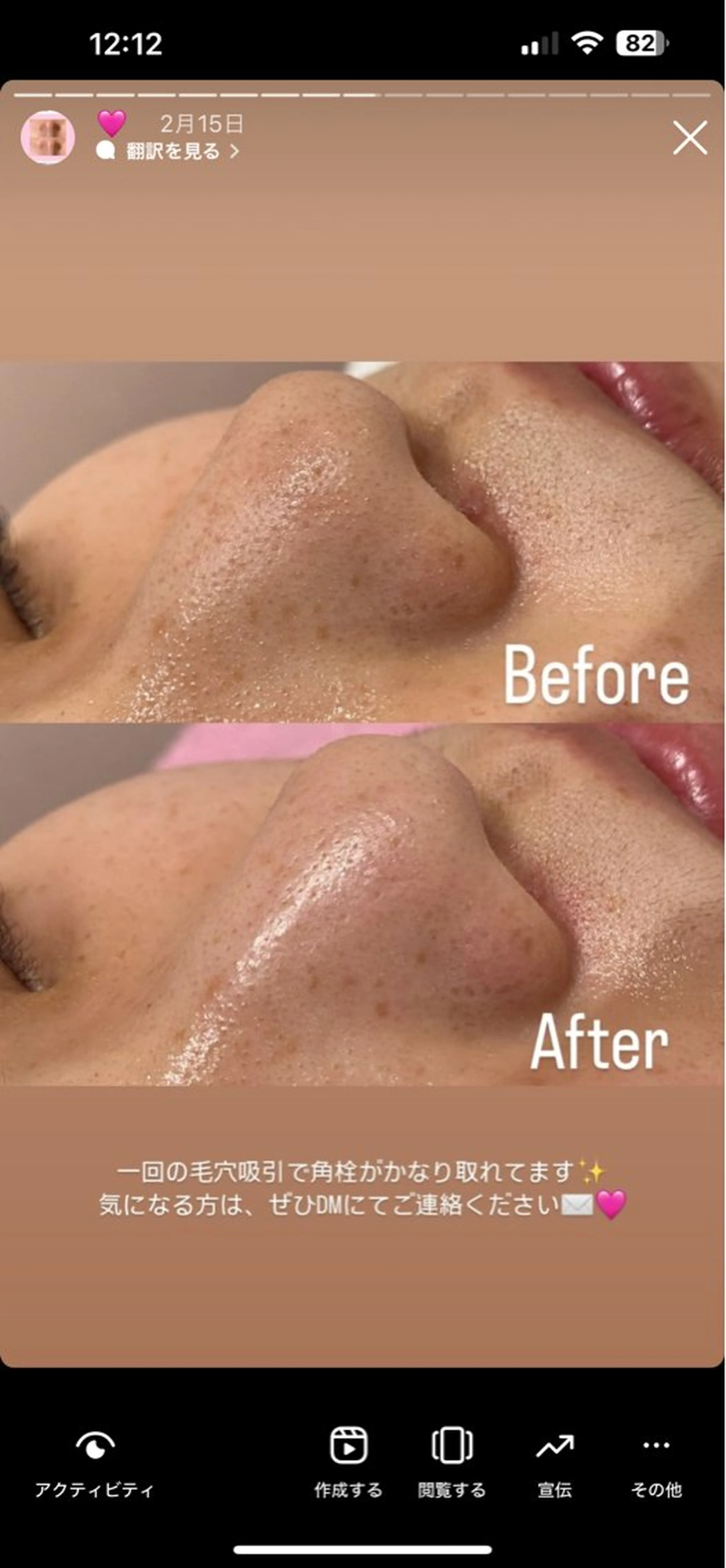 エステ 韓国肌管理専門店　White labo 宝塚店所属・有川 凜のエステ・リラクイメージ