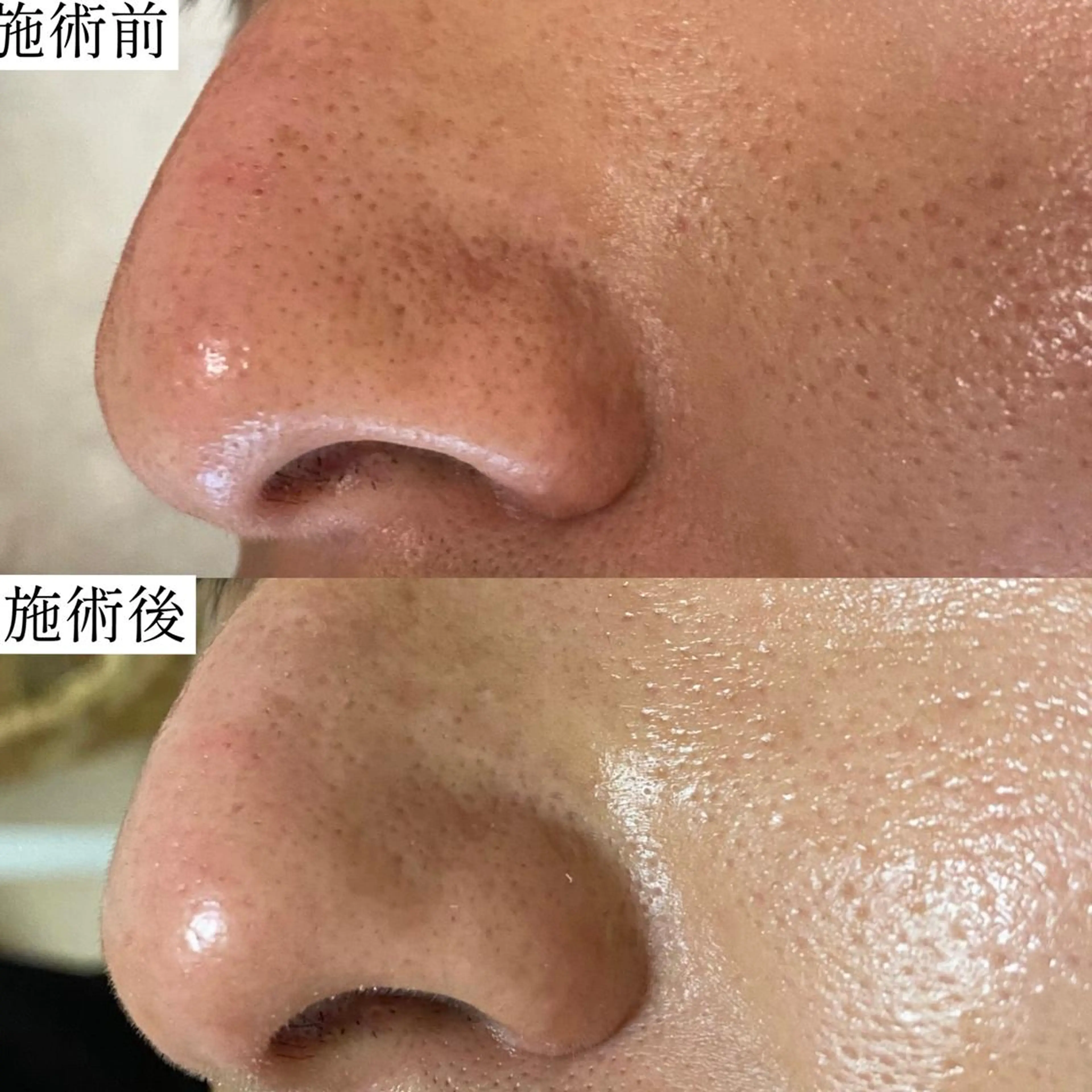 毛穴専門サロン　フルール所属・フルールFululu 自由が丘のエステ・リラクイメージ