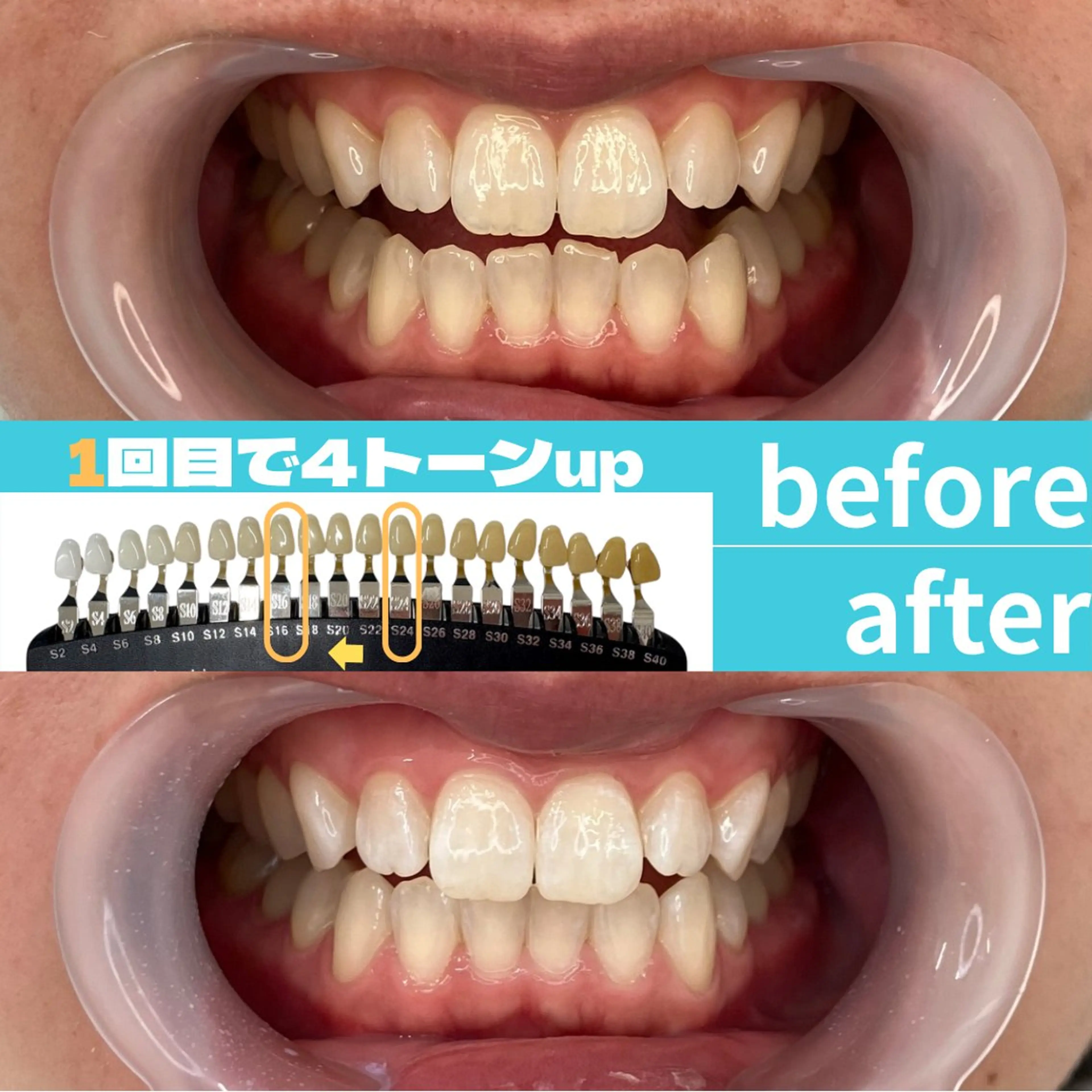 【都度払い】汚れ黄ばみをしっかり落とすの写真