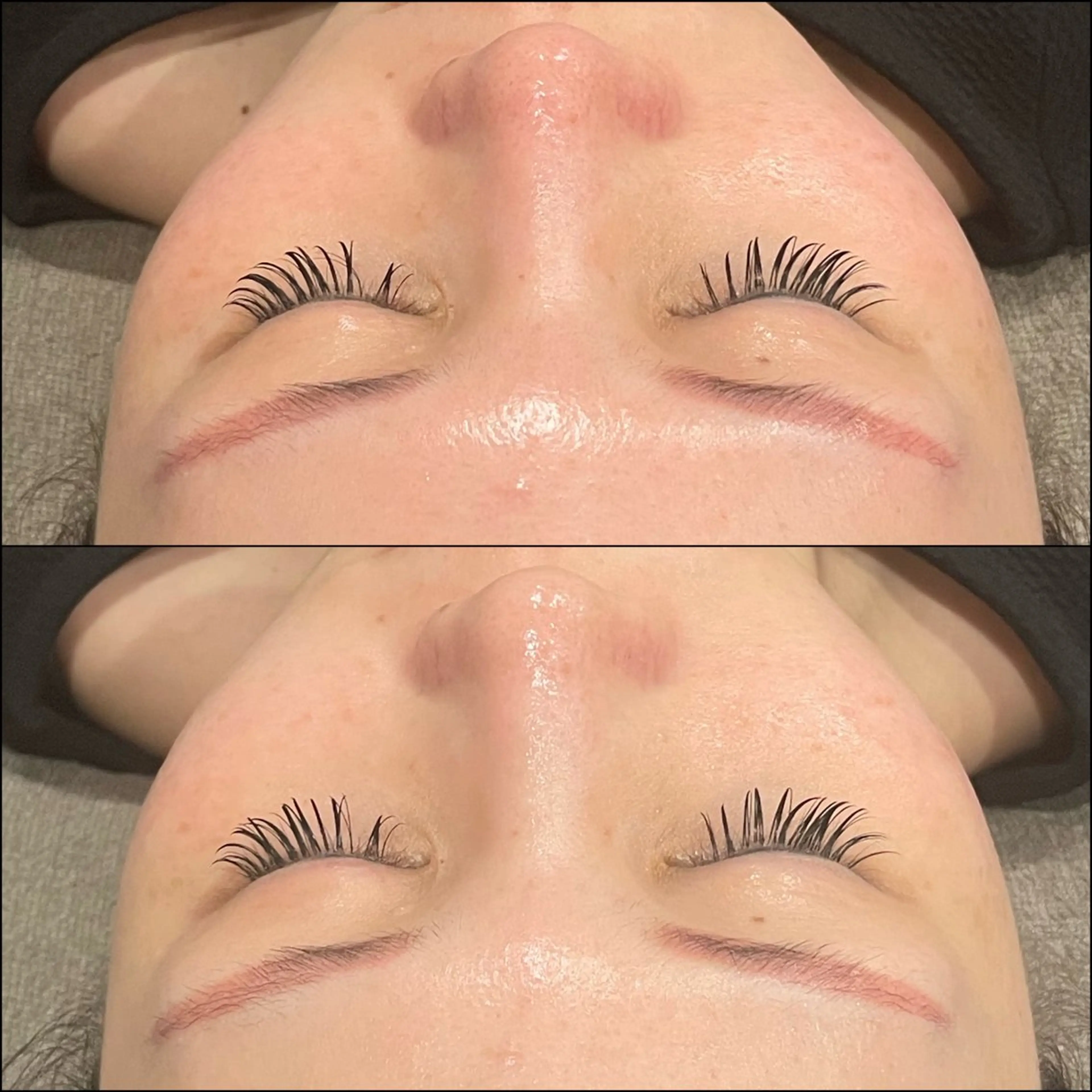 脱毛 LiZA エステティックサロンのエステ・リラクイメージ