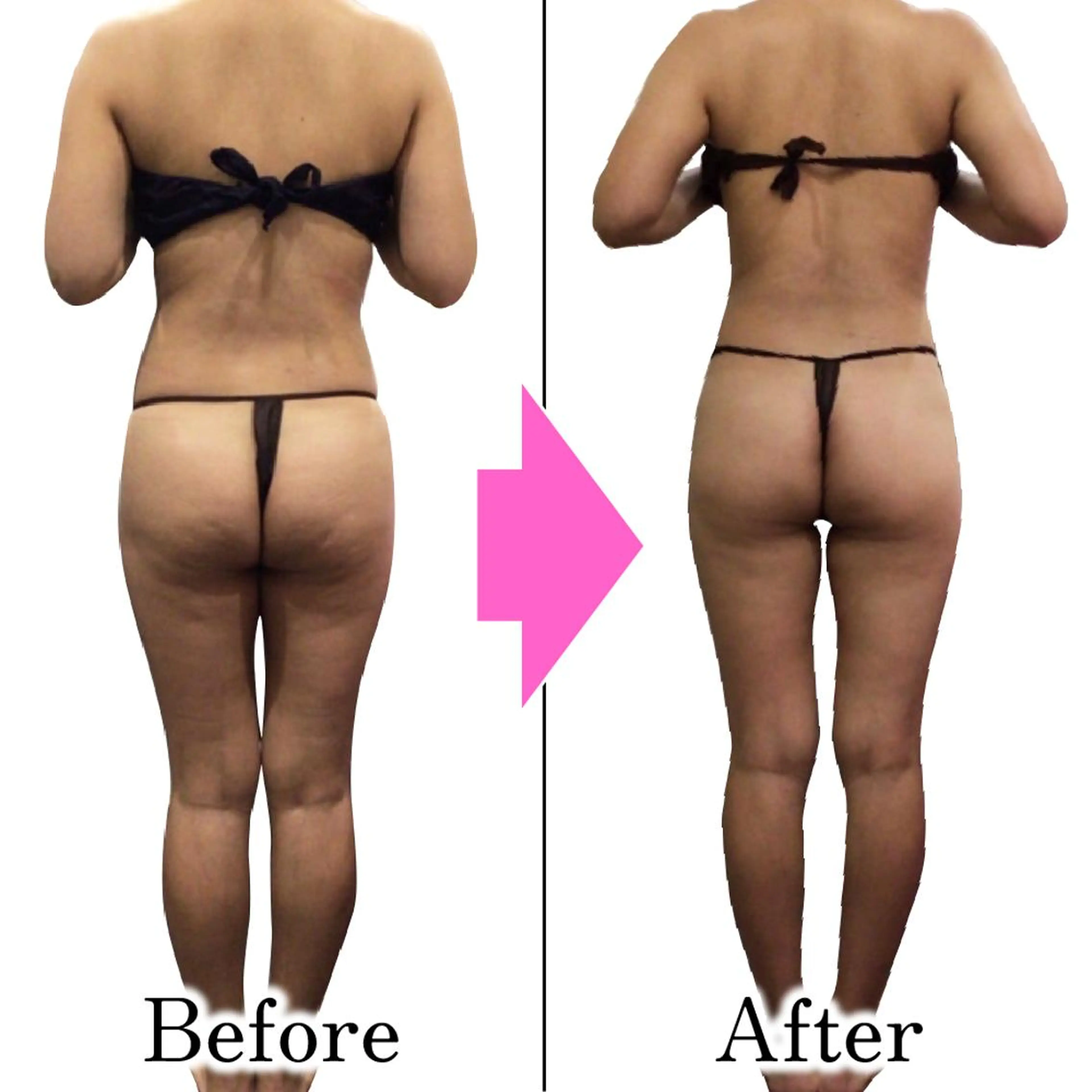 エステ ダイエットラボ梅田店 🌟のエステ・リラクイメージ