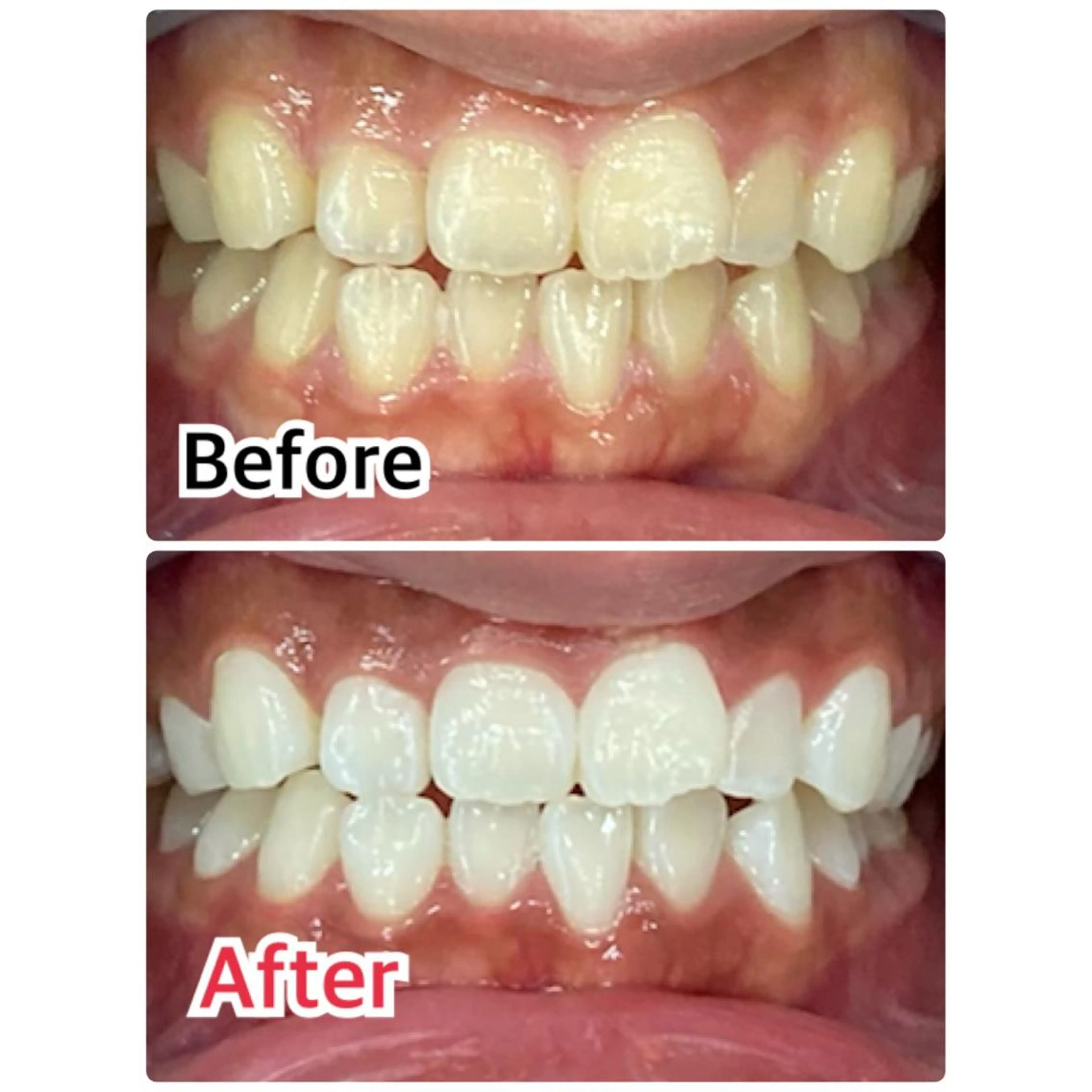 ネイル マツエク・マツパ アイブロウ プラチナムビューティー柏所属・【歯科提携】柏ホワイ トニングスタイルのその他イメージ