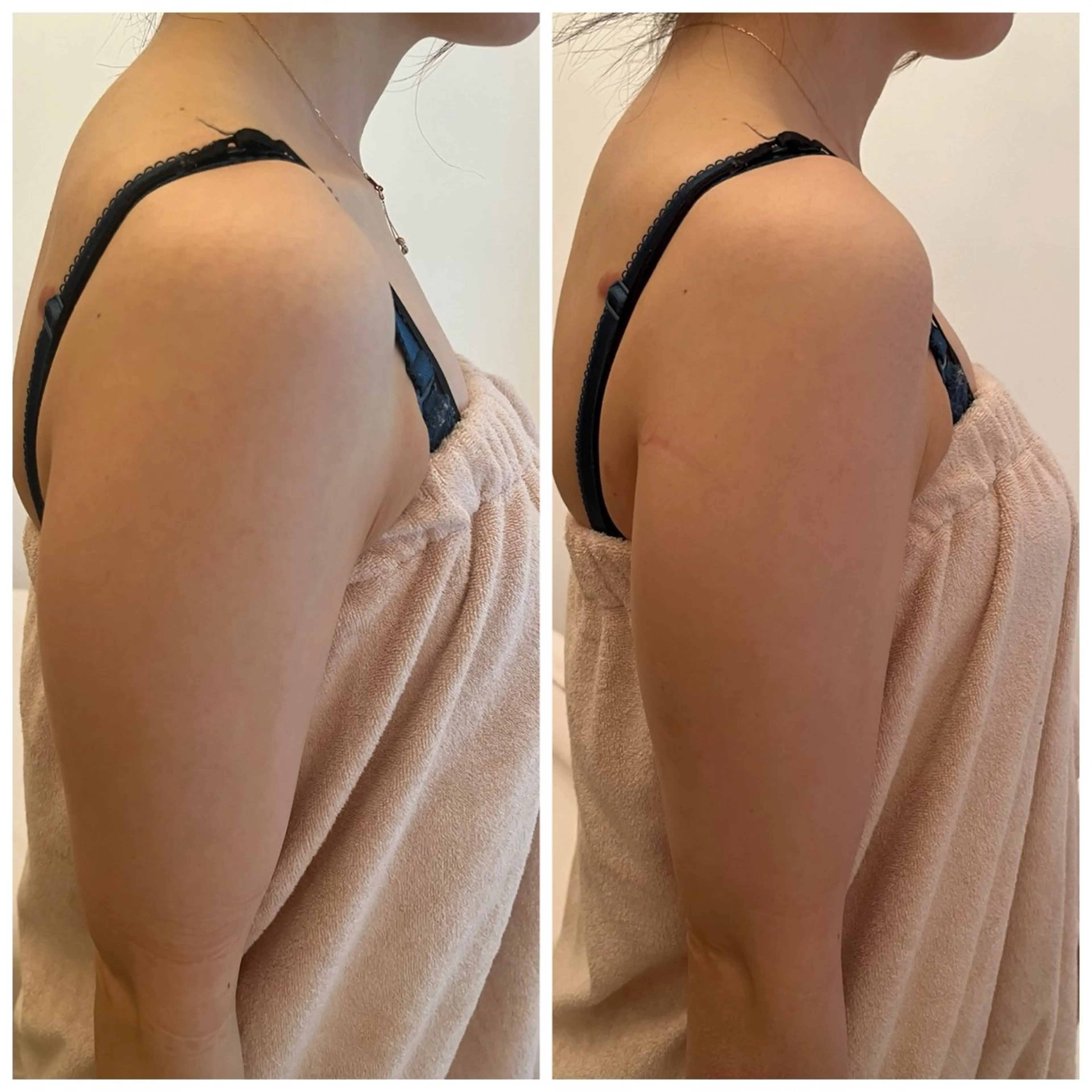 秒速小顔  恵比寿店所属・秒速小顔 恵比寿店 店長 さきのエステ・リラクイメージ