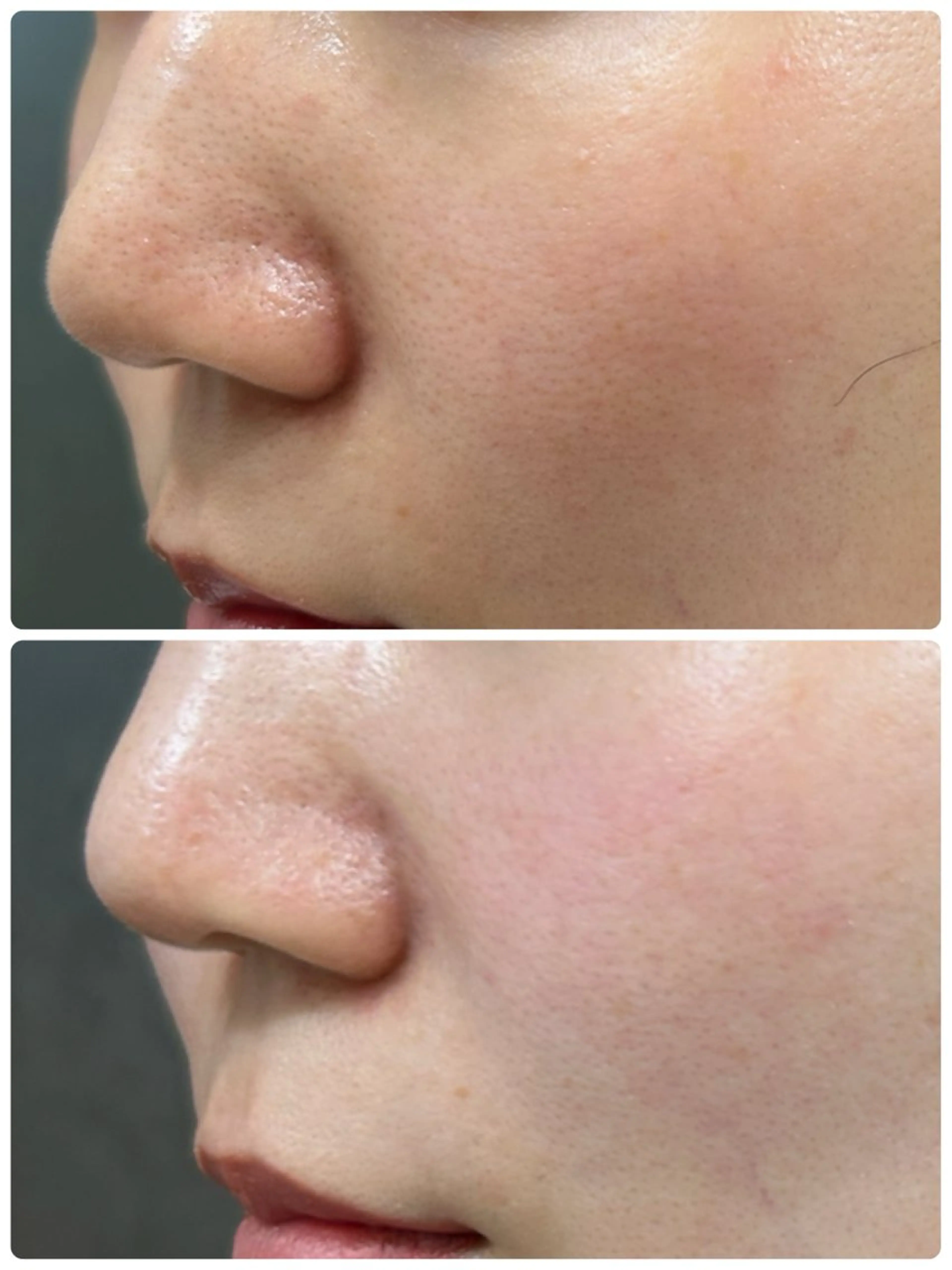 エステ 艶肌/角質ケア フェイシャルワックスのエステ・リラクイメージ