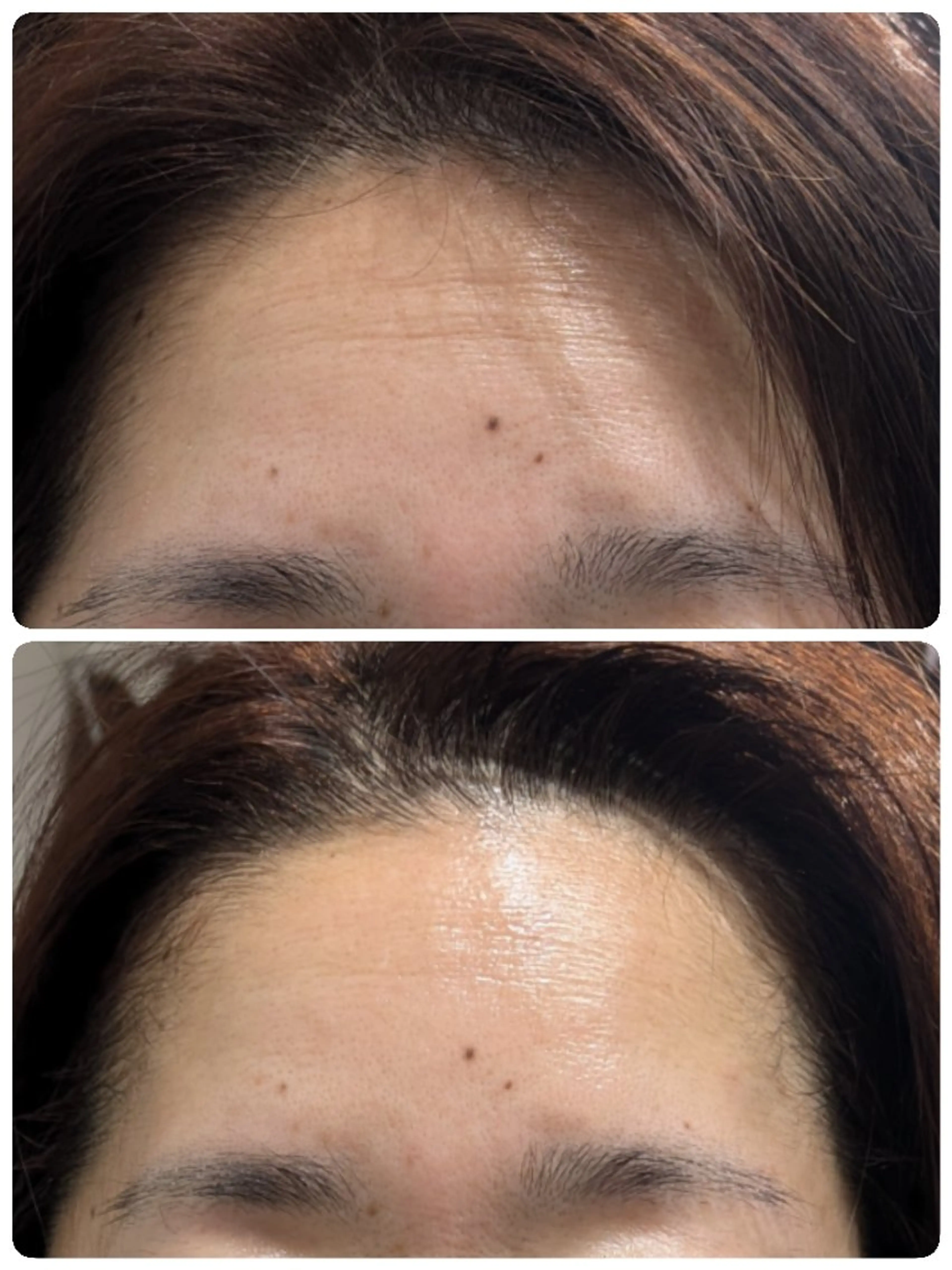 フェイシャルエステ アンソン・ドゥのエステ・リラクイメージ