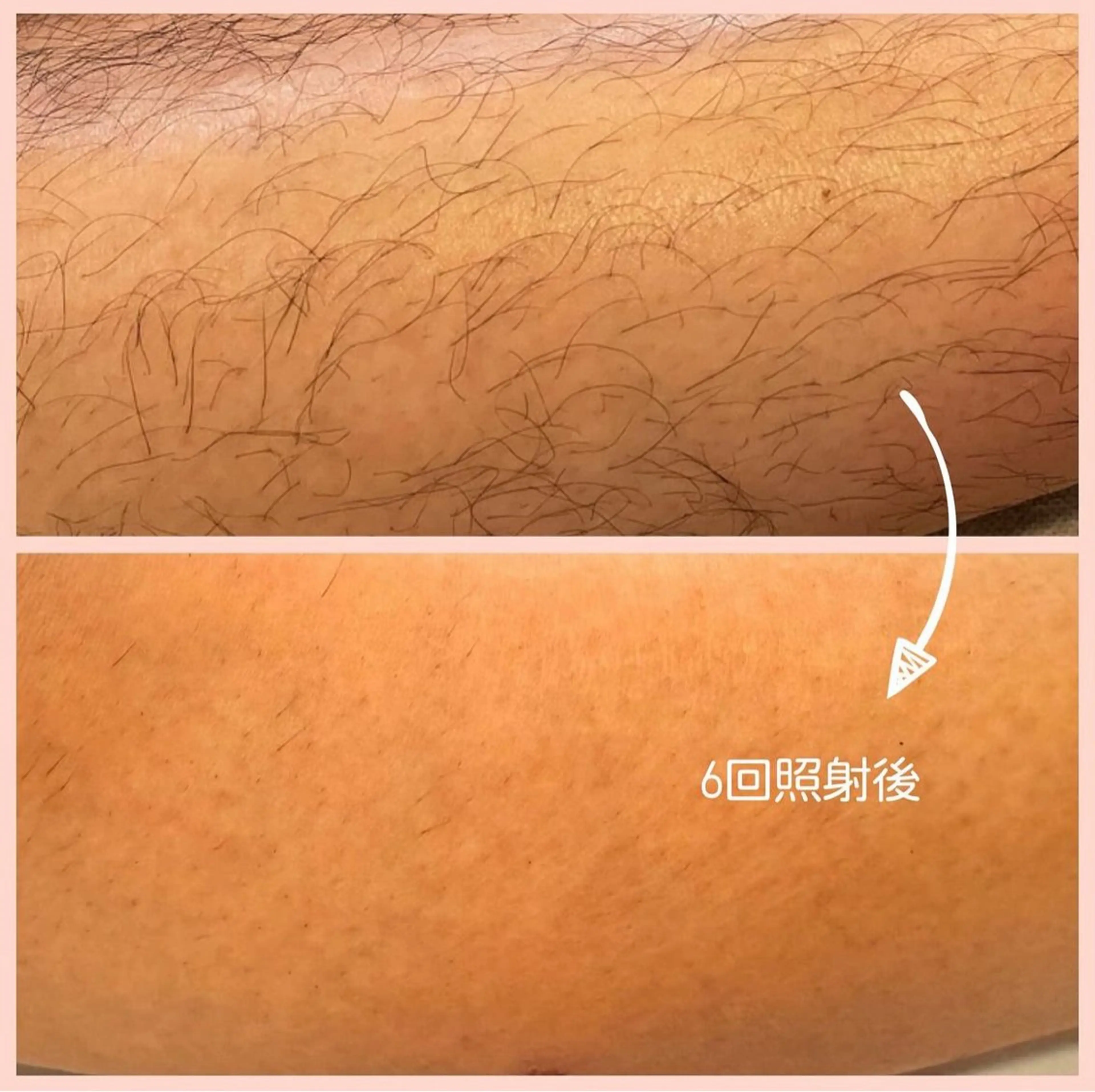 private脱毛salon HALE所属・private脱毛 salon HALEのエステ・リラクイメージ