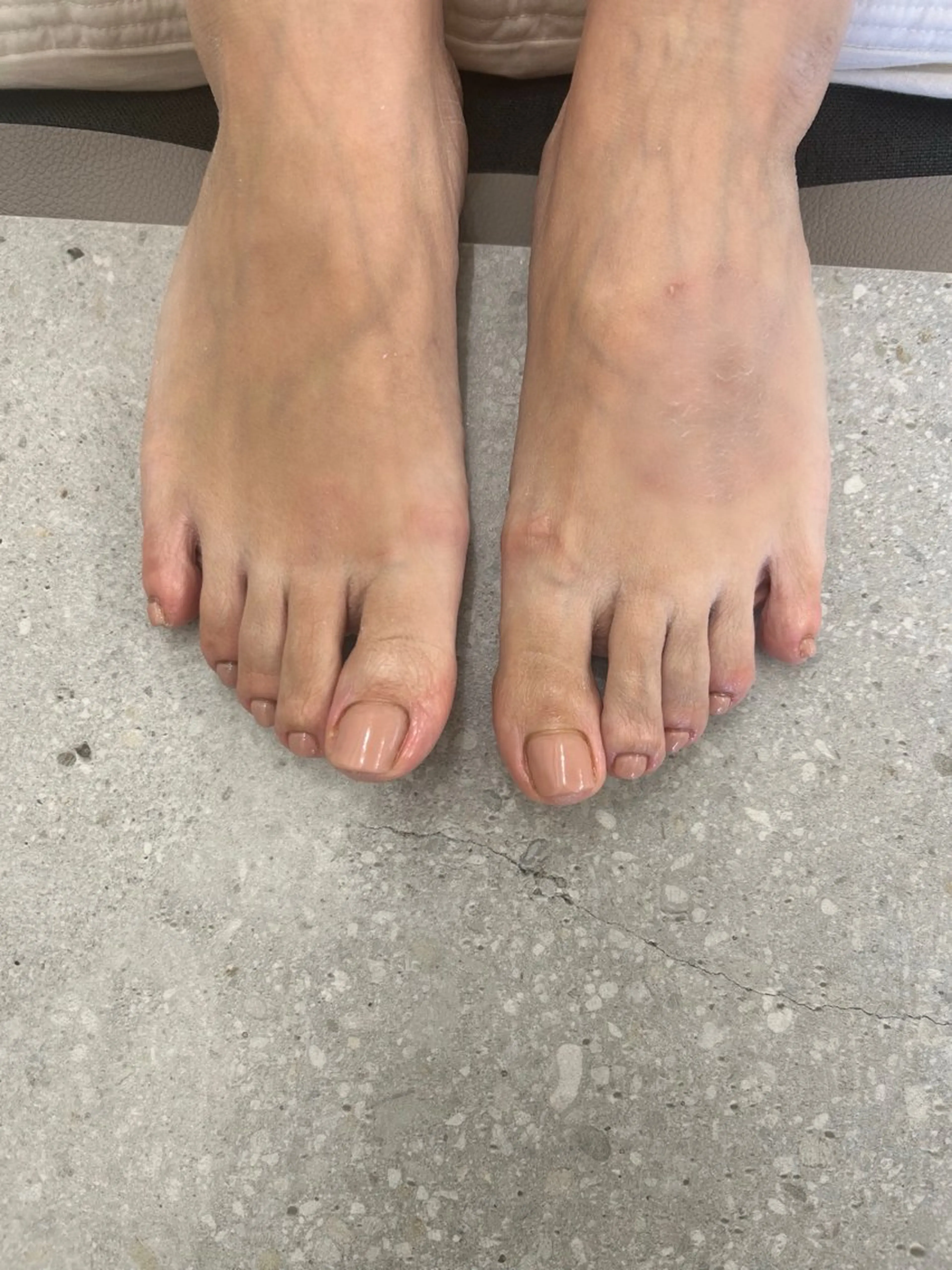 2200円(材料費)／フット(オフありワンカラー)の写真