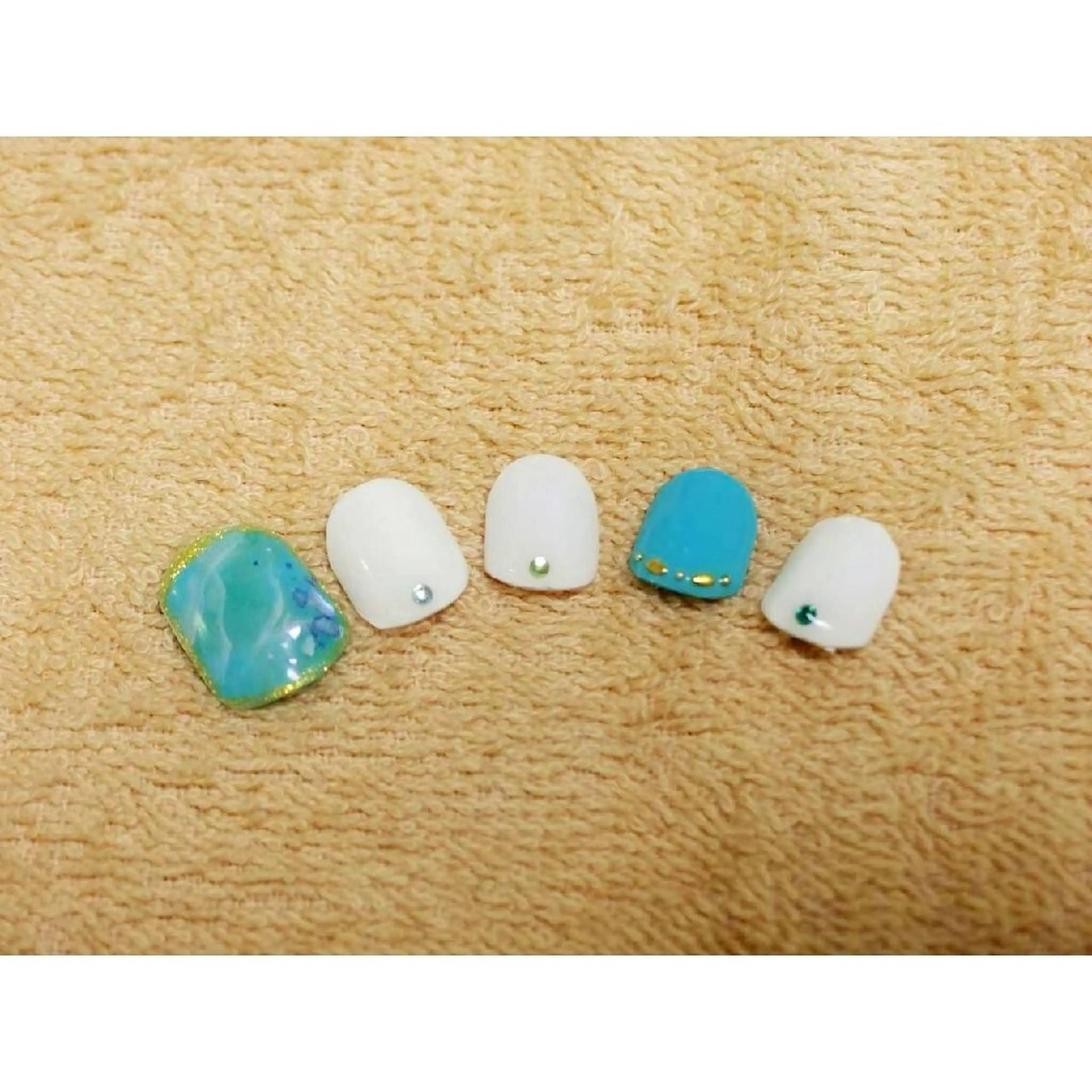 ネイル フットネイル 痛ネイル/ワンホン/ フィルイン/長さだしのネイルデザイン