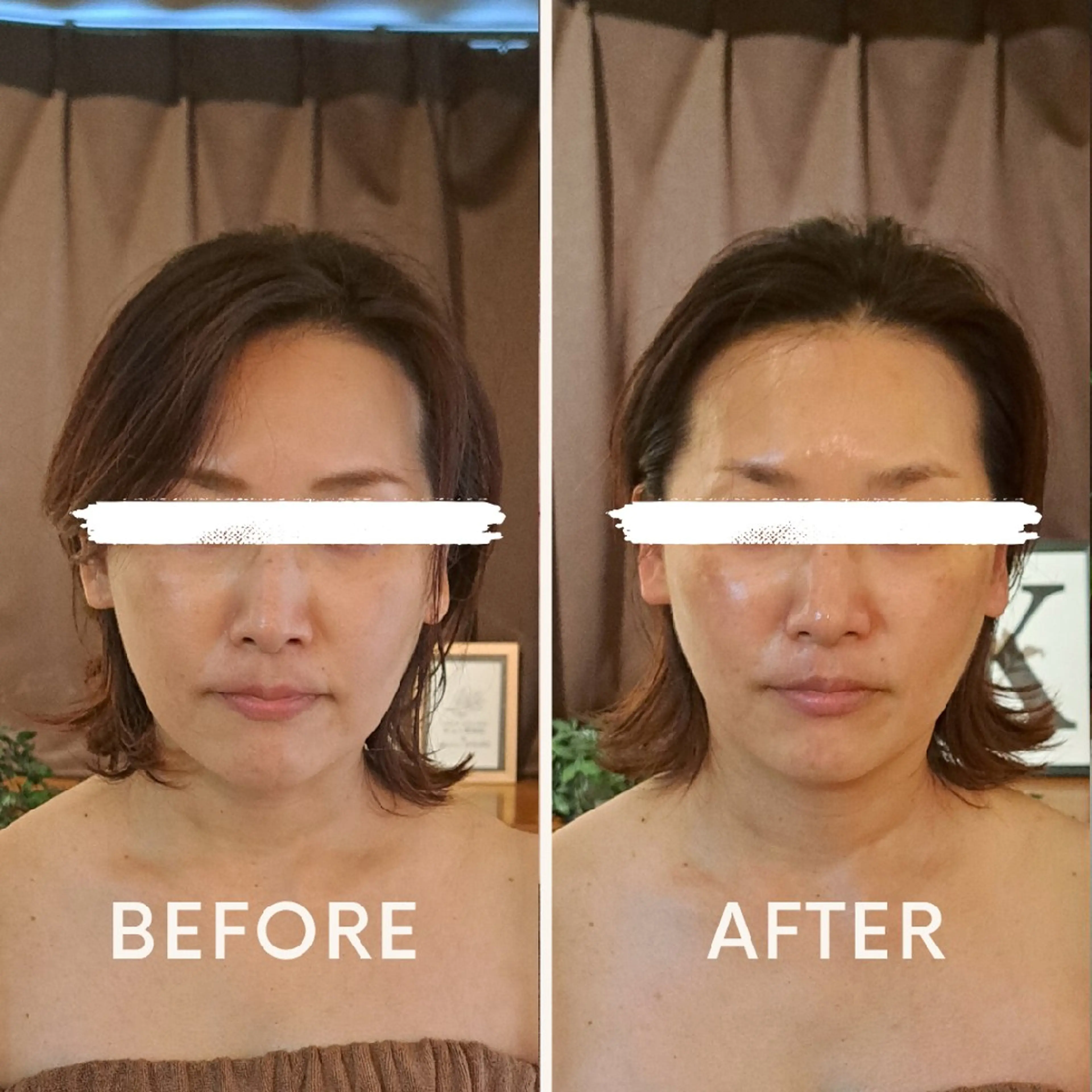 エステ リラク 鍼灸サロンmiyabi所属・美容鍼×エステ　鍼灸 サロンmiyabiのエステ・リラクイメージ