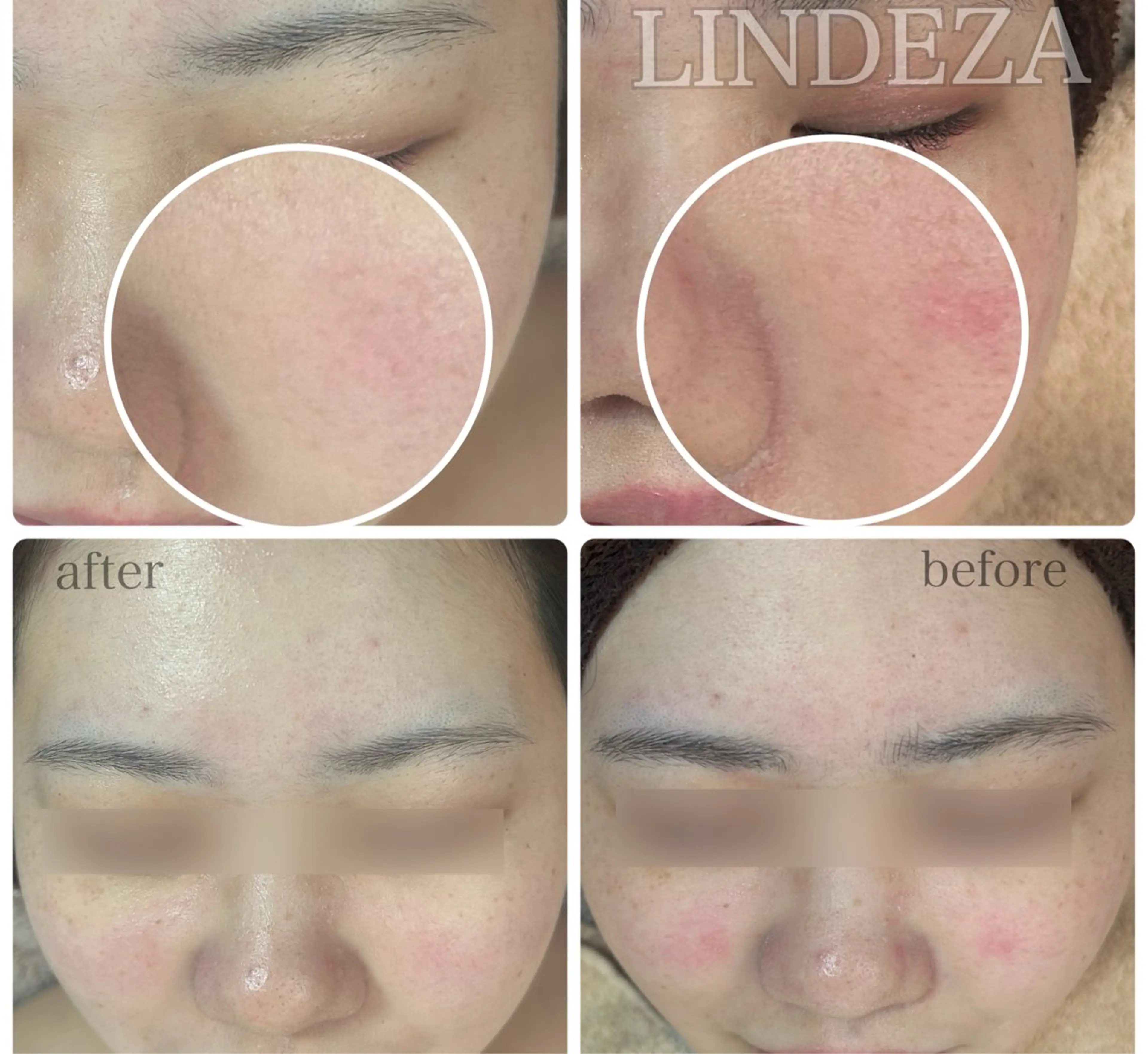 private salon 𝐋𝐈𝐍𝐃𝐄𝐙𝐀所属・LINDEZA Ayaのエステ・リラクイメージ