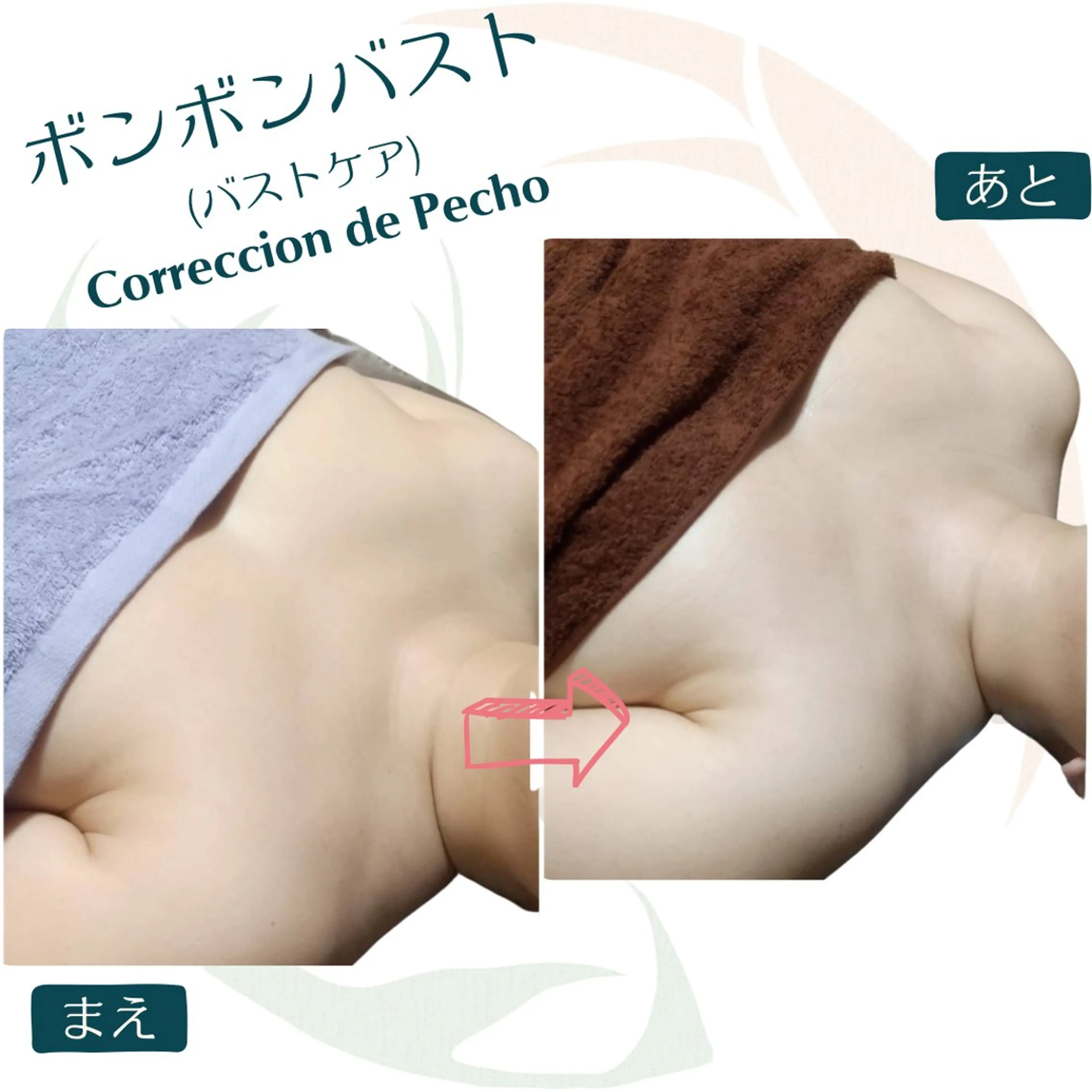 小顔矯正☀︎バスト ☀︎ハルのエステ・リラクイメージ