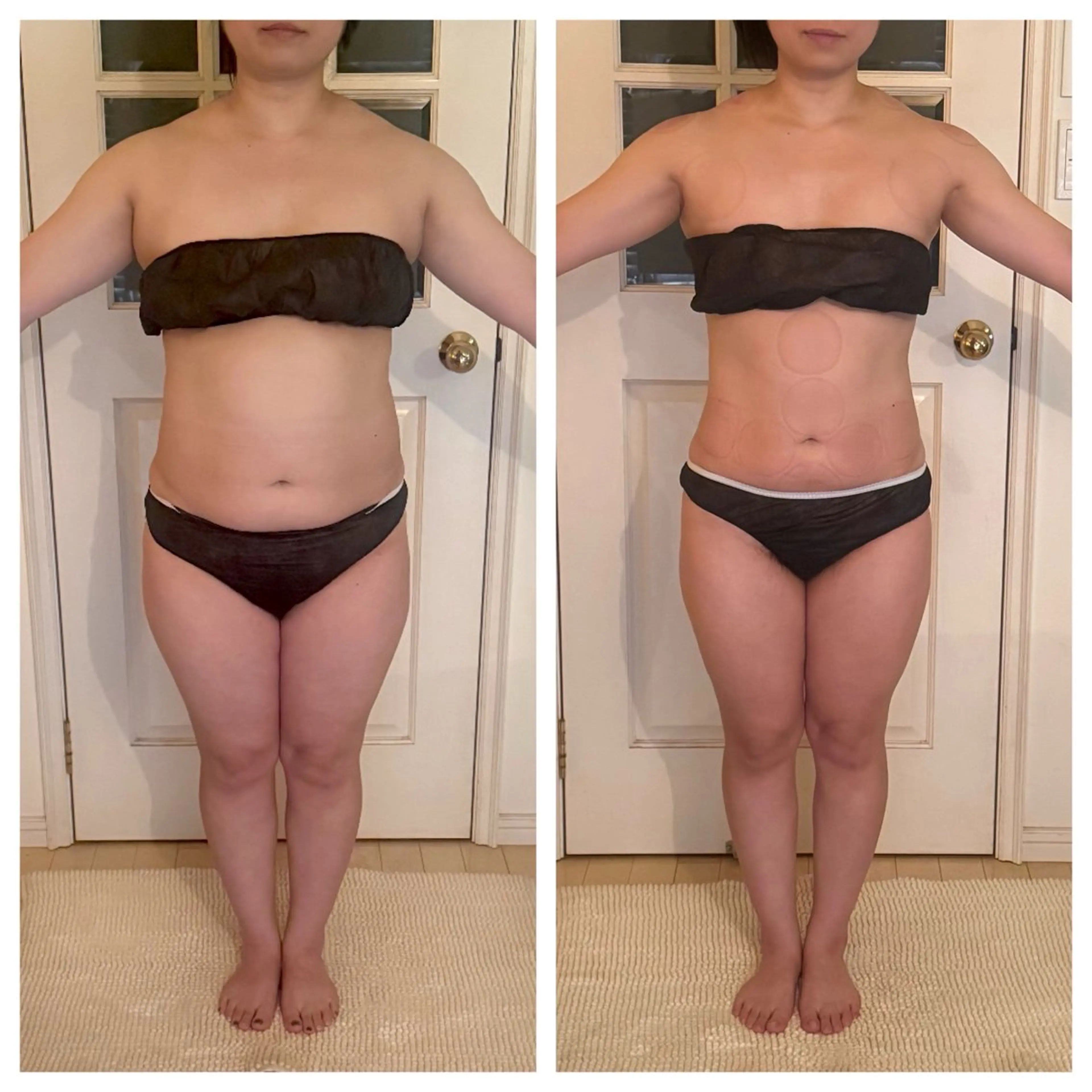 エステ リラク SALON de FDL所属・超ド級痩身/ 肩こり撃退のエステ・リラクイメージ