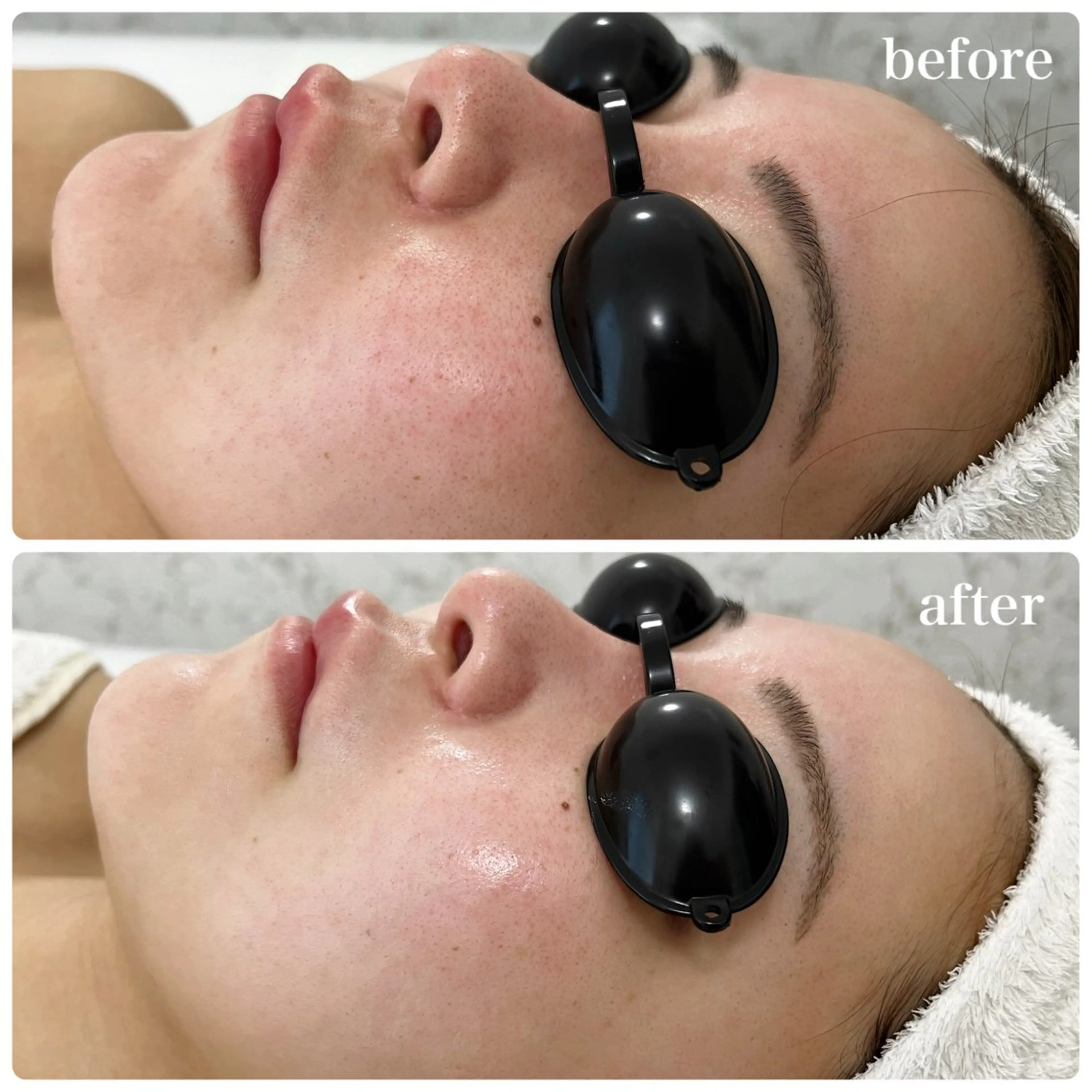 Liam《美肌管理/ 3D小顔/脂肪ケア》のエステ・リラクイメージ