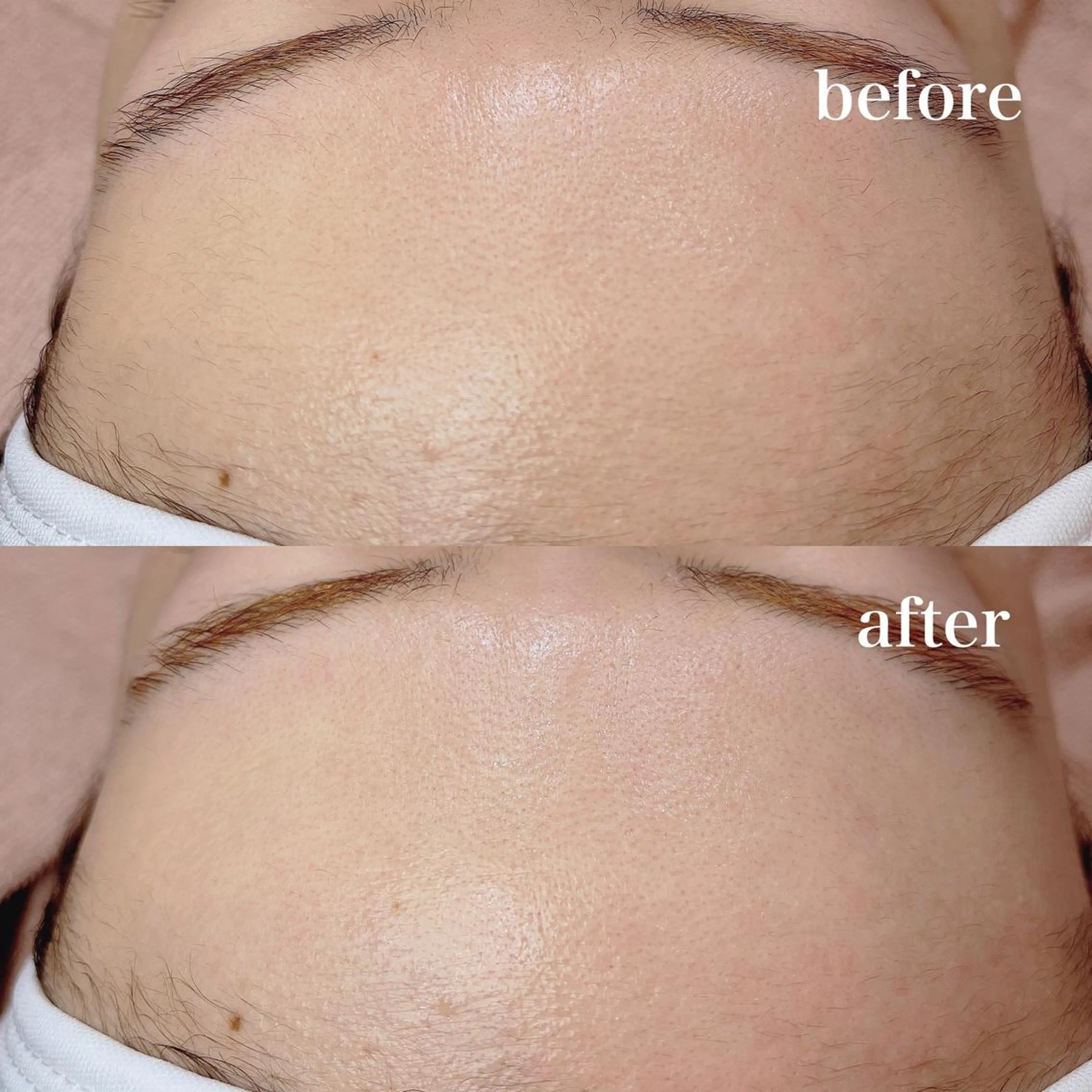 cococherin所属・araki 🧸💭のマツエク・マツパデザイン