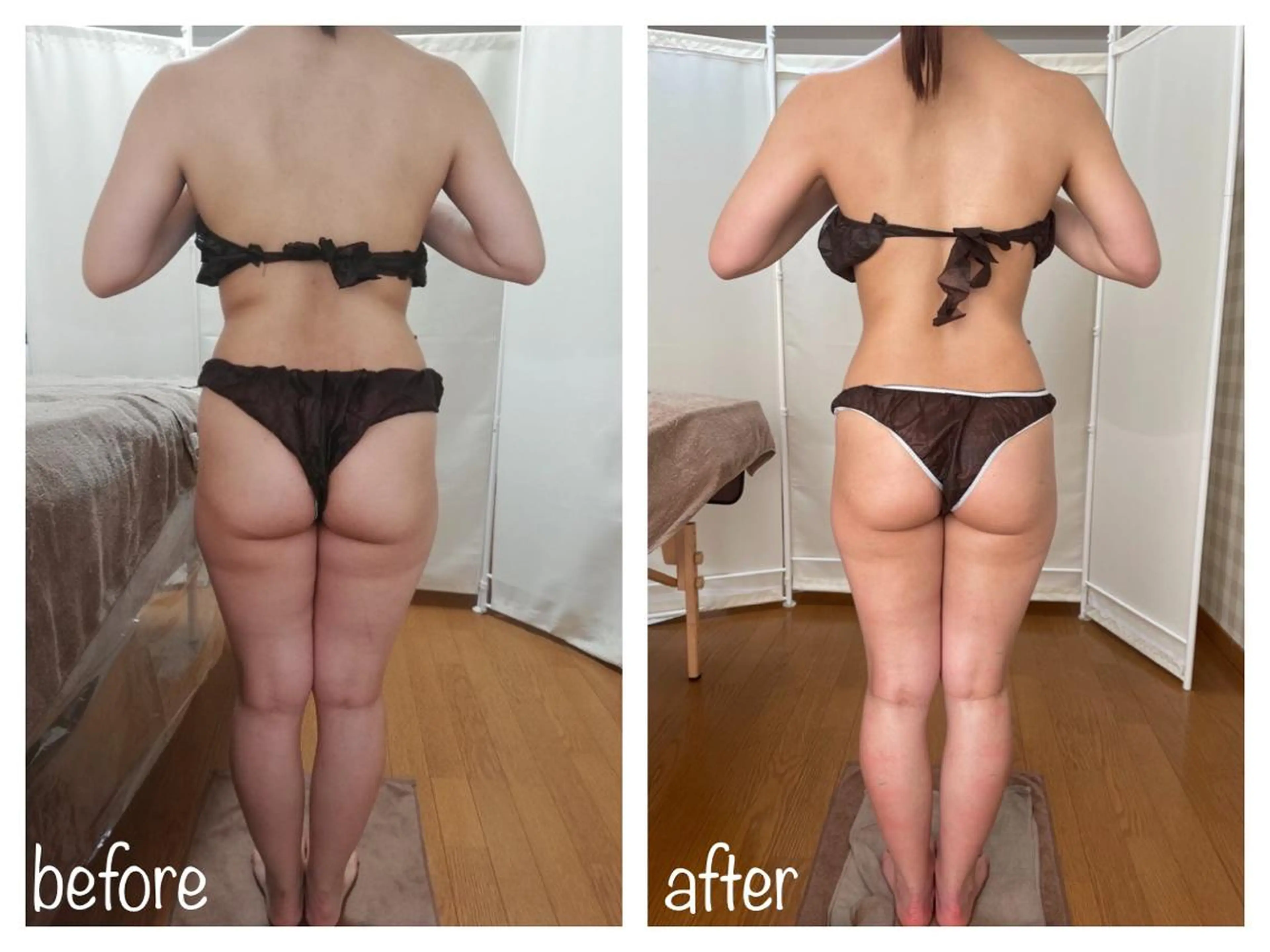 biloop所属・《痩身×疲労改善》 BILOOPのエステ・リラクイメージ