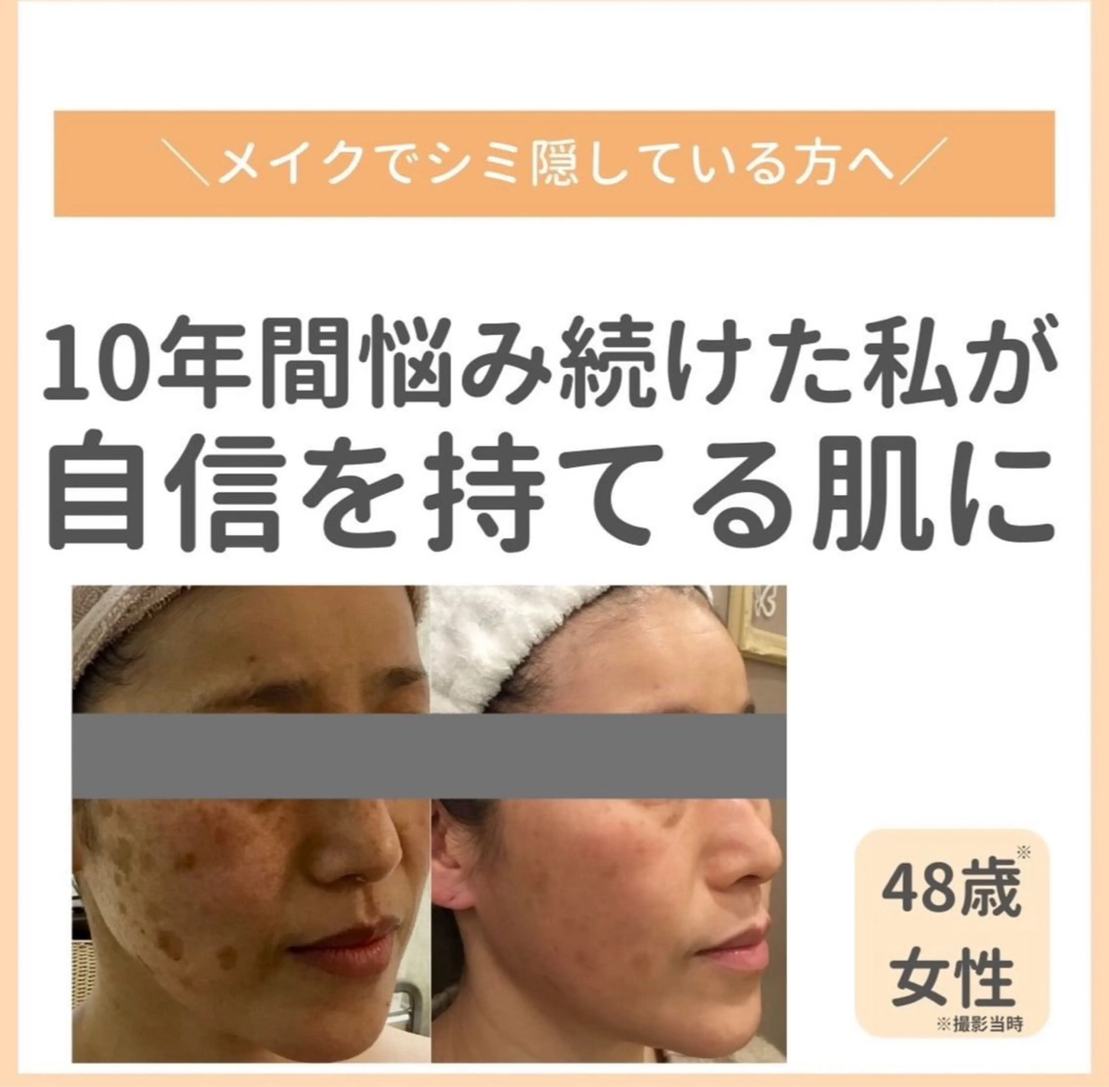 private salon  Dea_maris シュガーリング＆パーソナルボディケア所属・シミ改善・韓国肌管理 ボディメイク痩身のその他イメージ