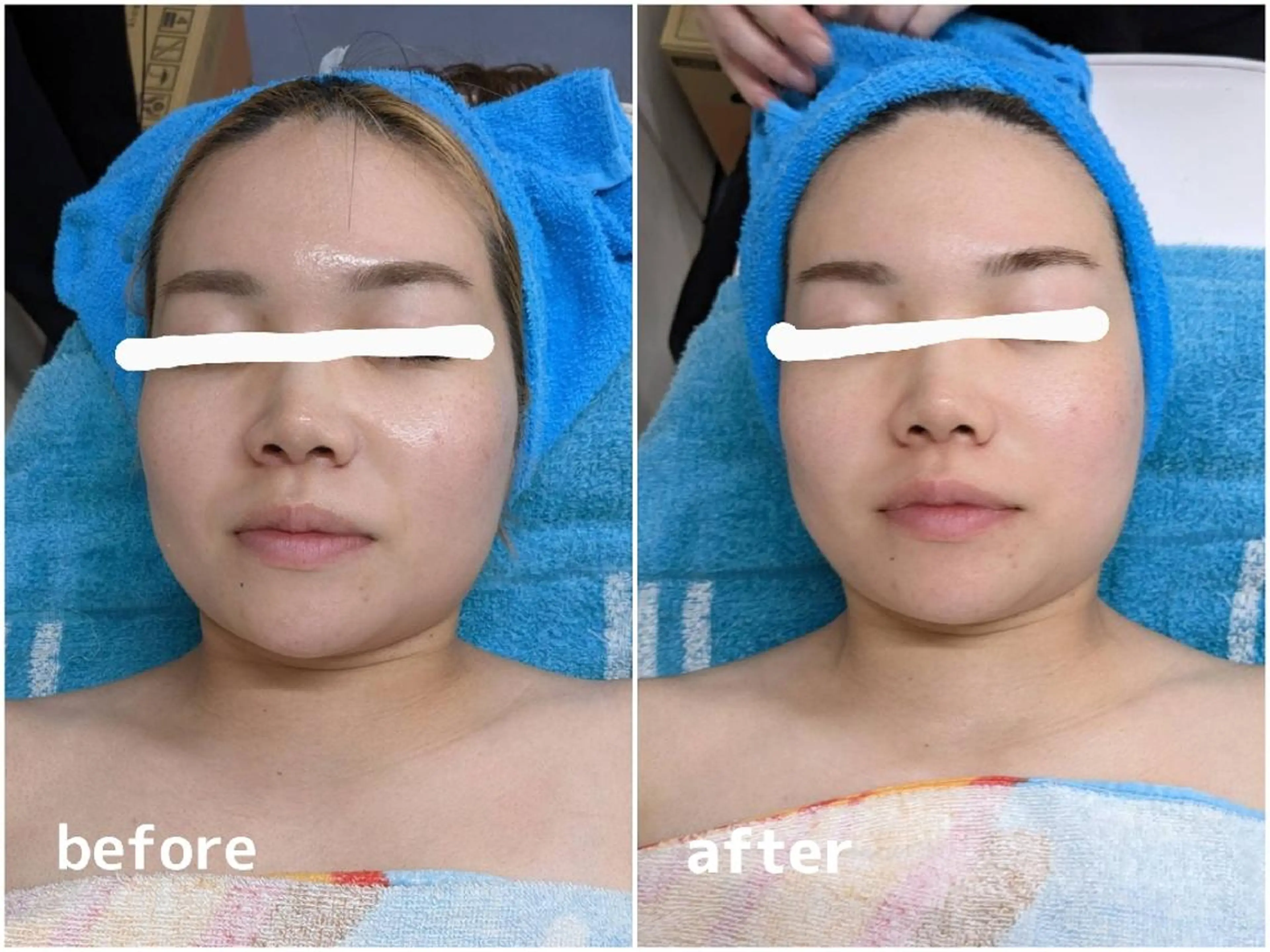 kirakira所属・ʏᴜᴋᴀ /ᴋɪʀᴀᴋɪʀᴀのマツエク・マツパデザイン