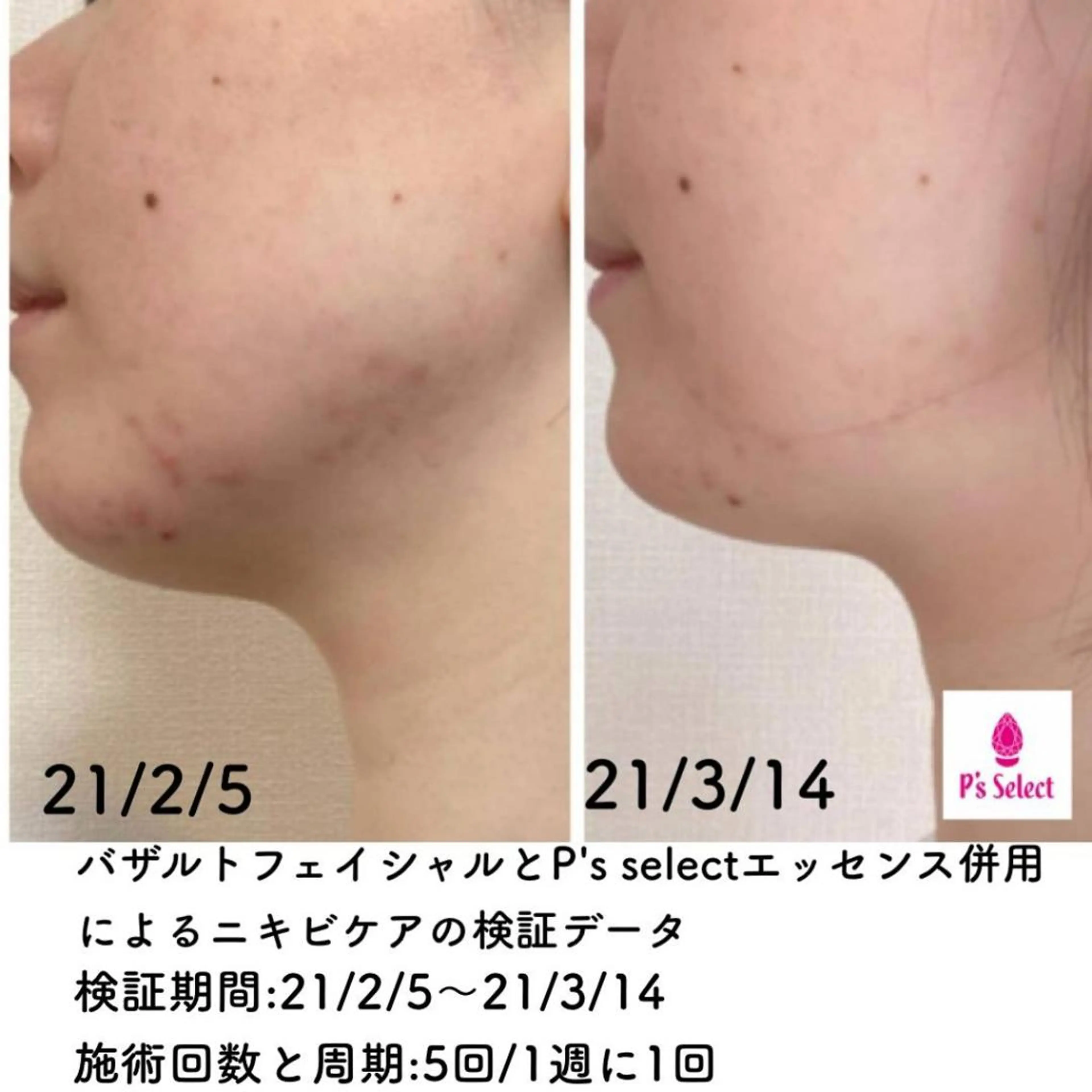 エステ Beauty style +α所属・目々澤 智恵子のエステ・リラクイメージ