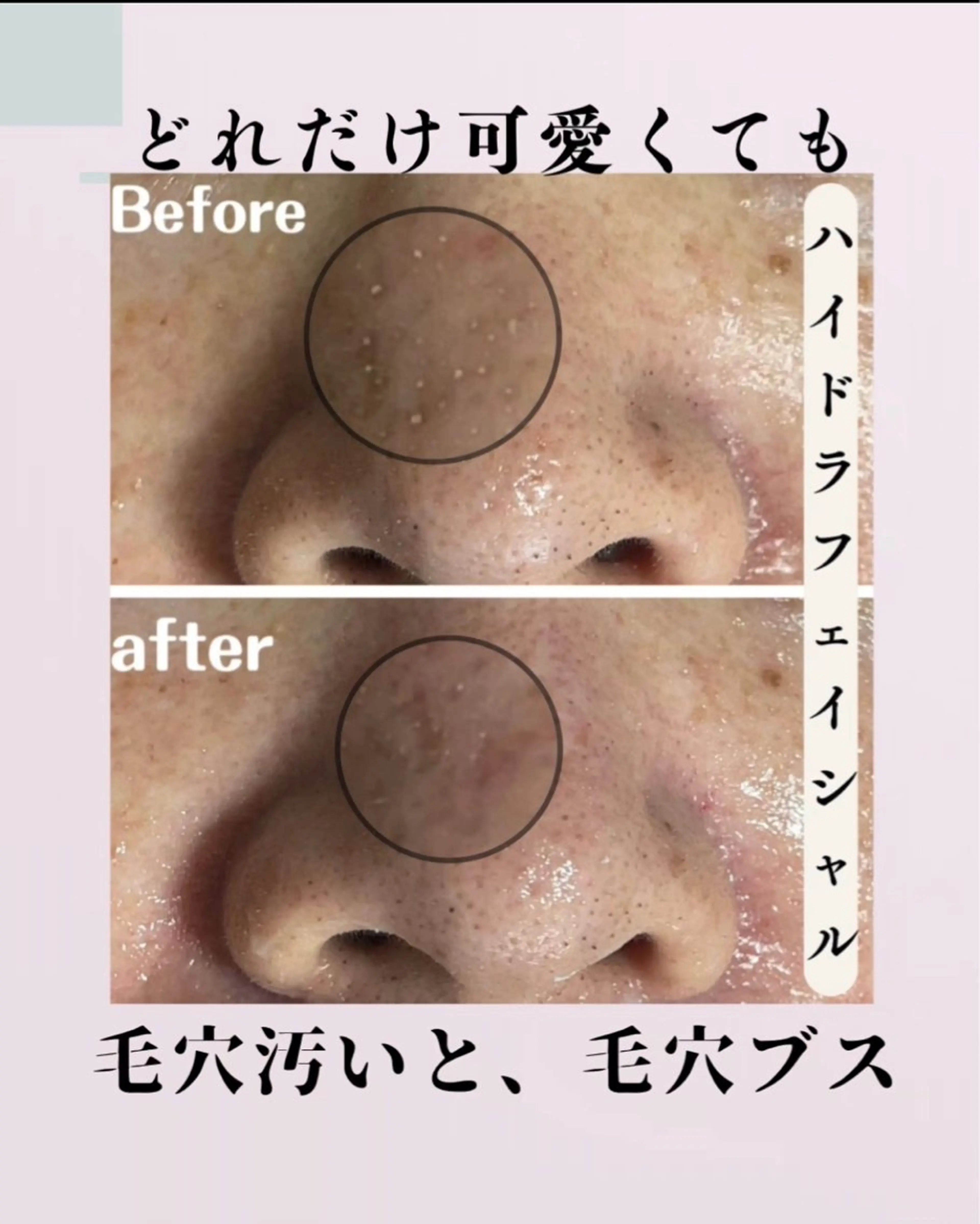 肌質改善サロン facialmoonのエステ・リラクイメージ