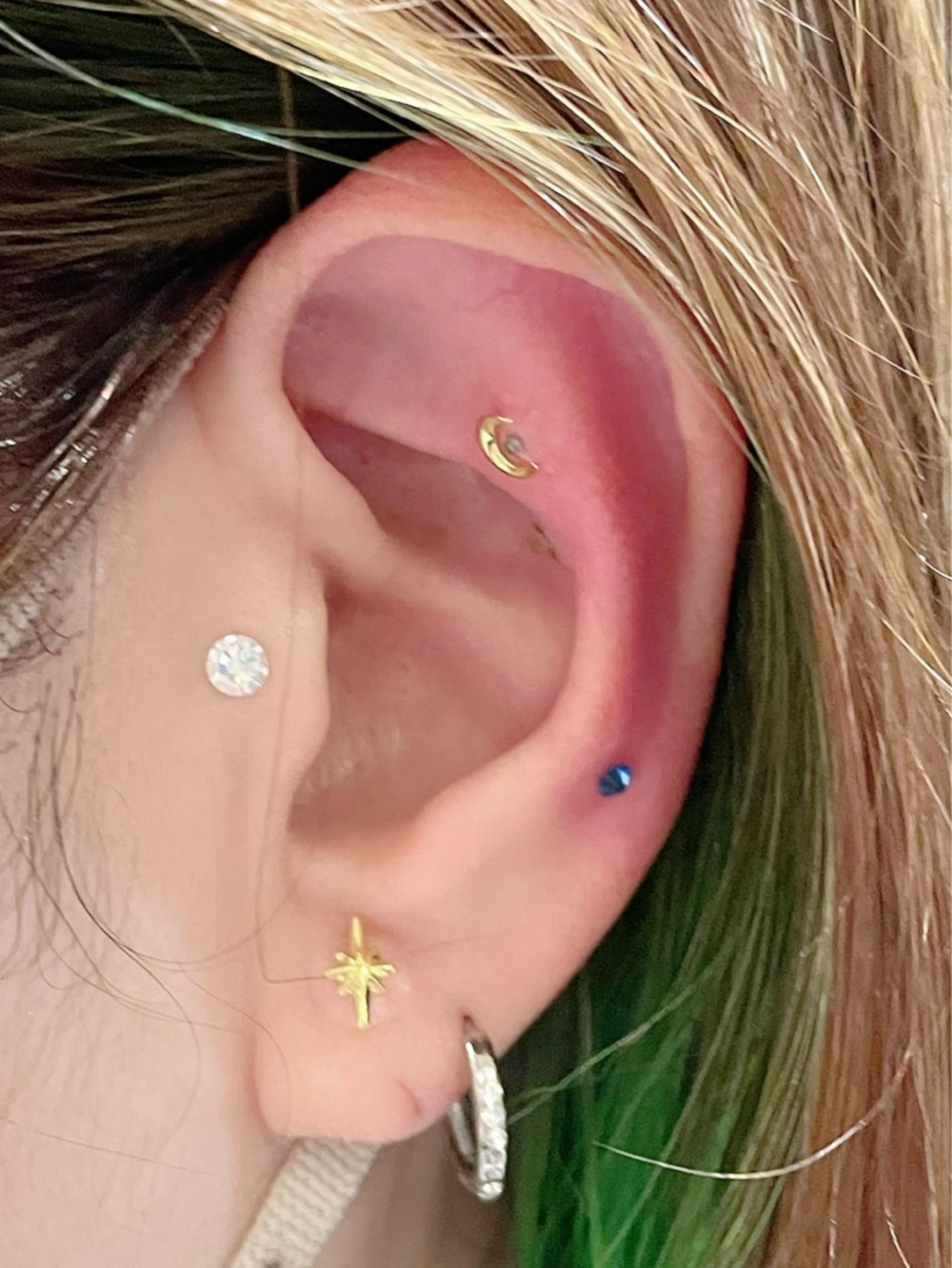 エステ リラク 痛くないシミ取り 【荻窪】石橋のヘアスタイル