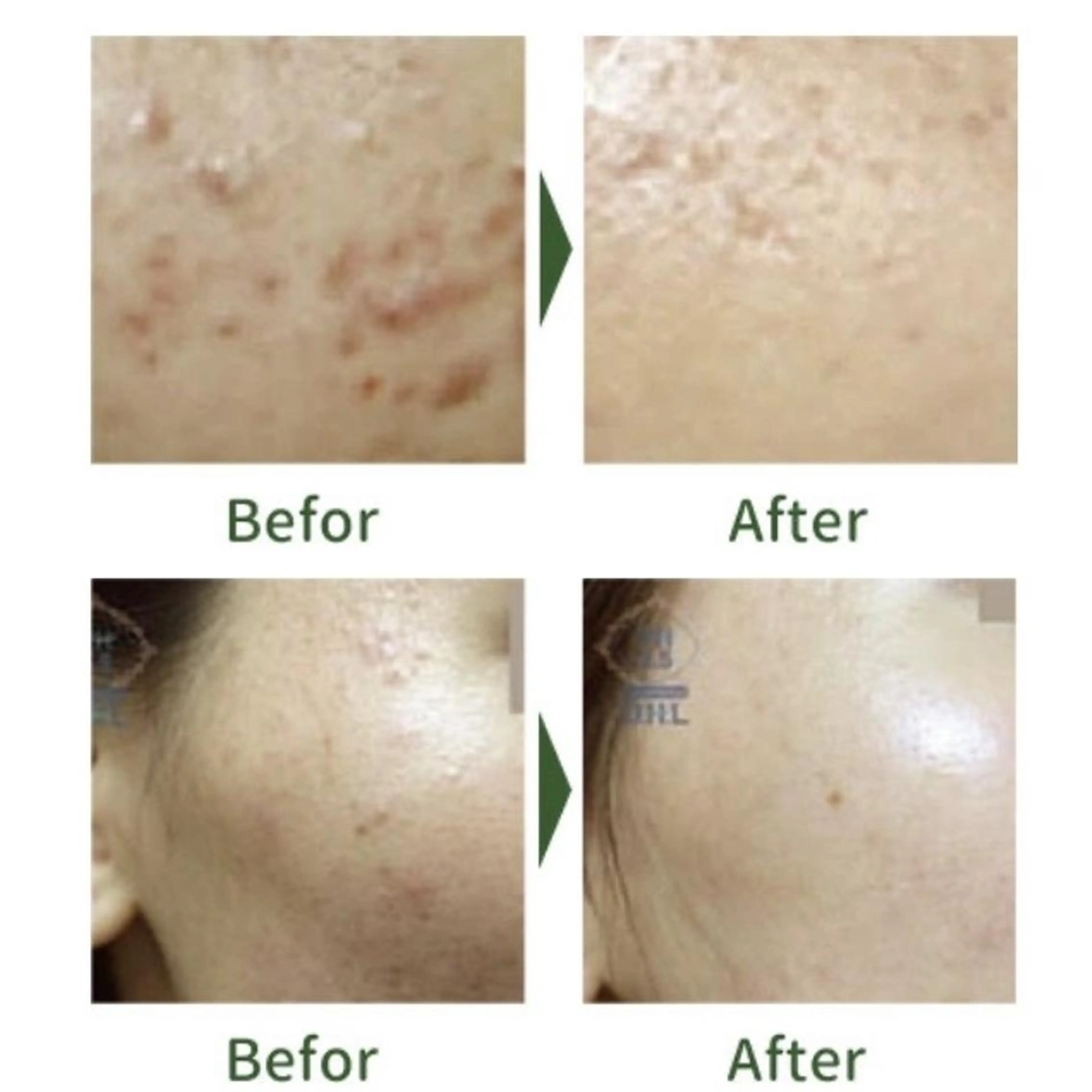 Belsia 千歳烏山のマツエク・マツパデザイン