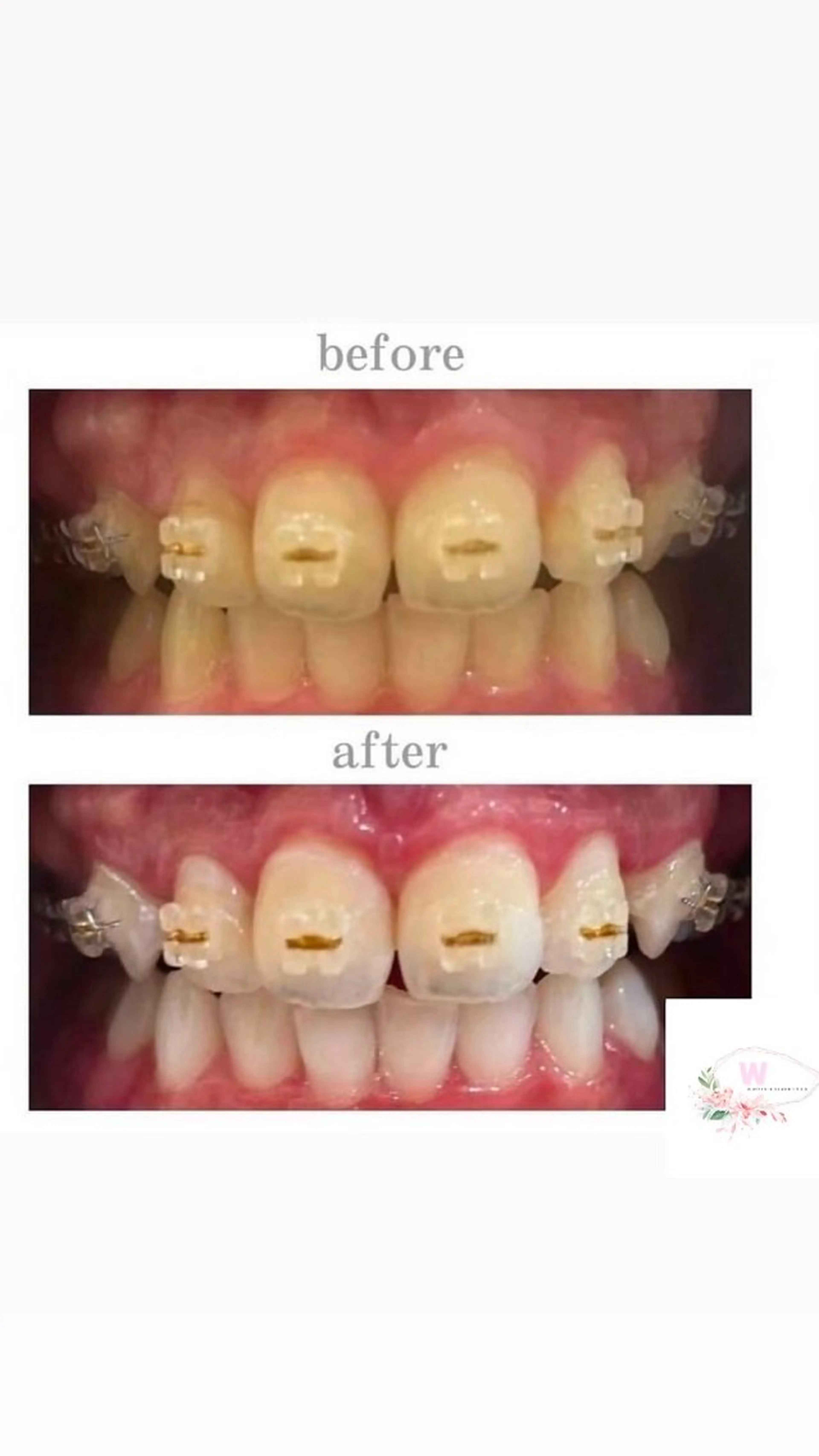 ホワイトニング ショップ本厚木のその他イメージ