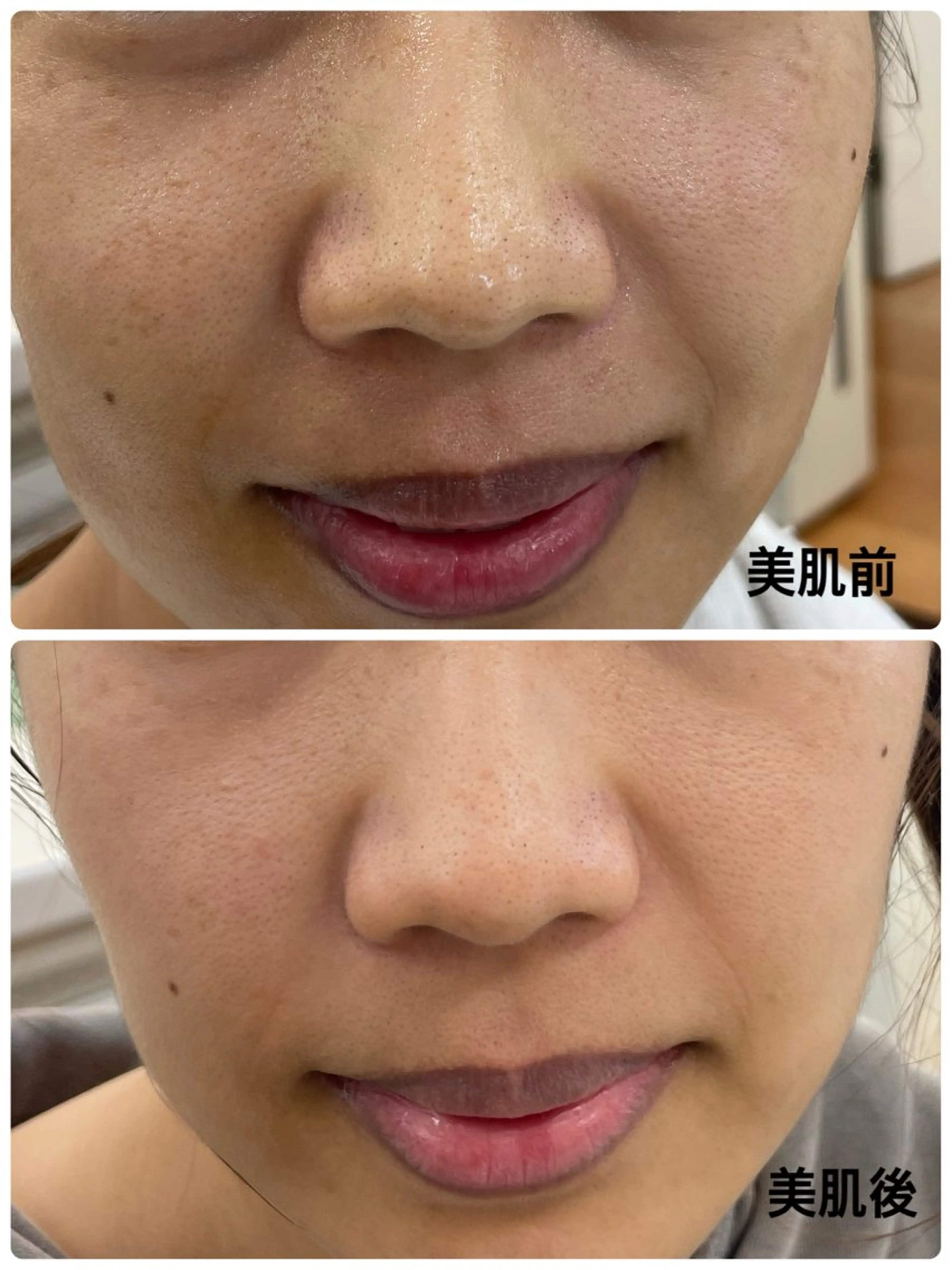 デアイム甲府所属・つかだ りょうこのエステ・リラクイメージ