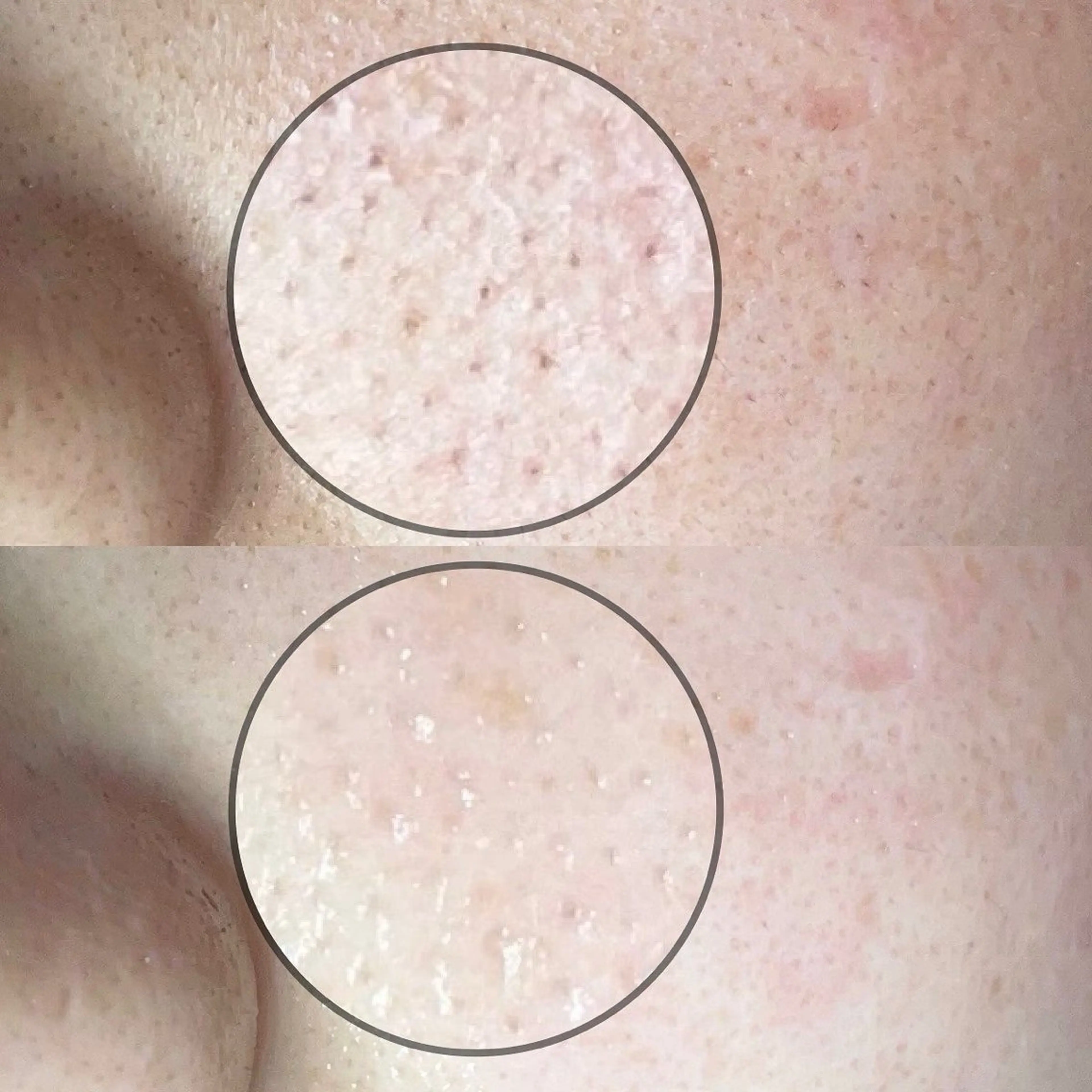 毛穴専門店MeMe.八千代店所属・\毛穴・頭皮/ のお悩みに特化💪のその他イメージ