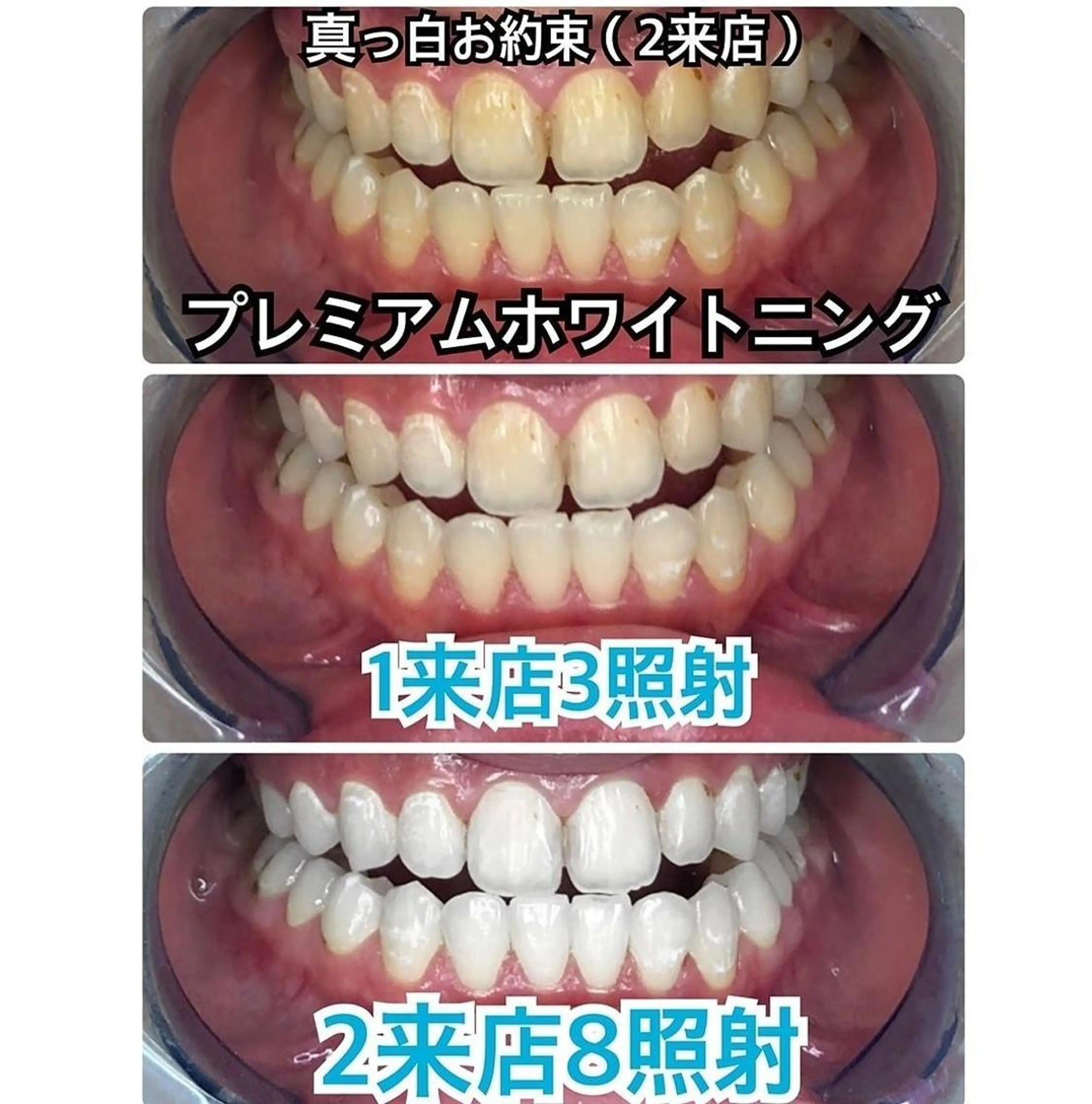 プラチナムビューティー柏所属・【歯科提携】柏ホワイ トニングスタイルのその他イメージ