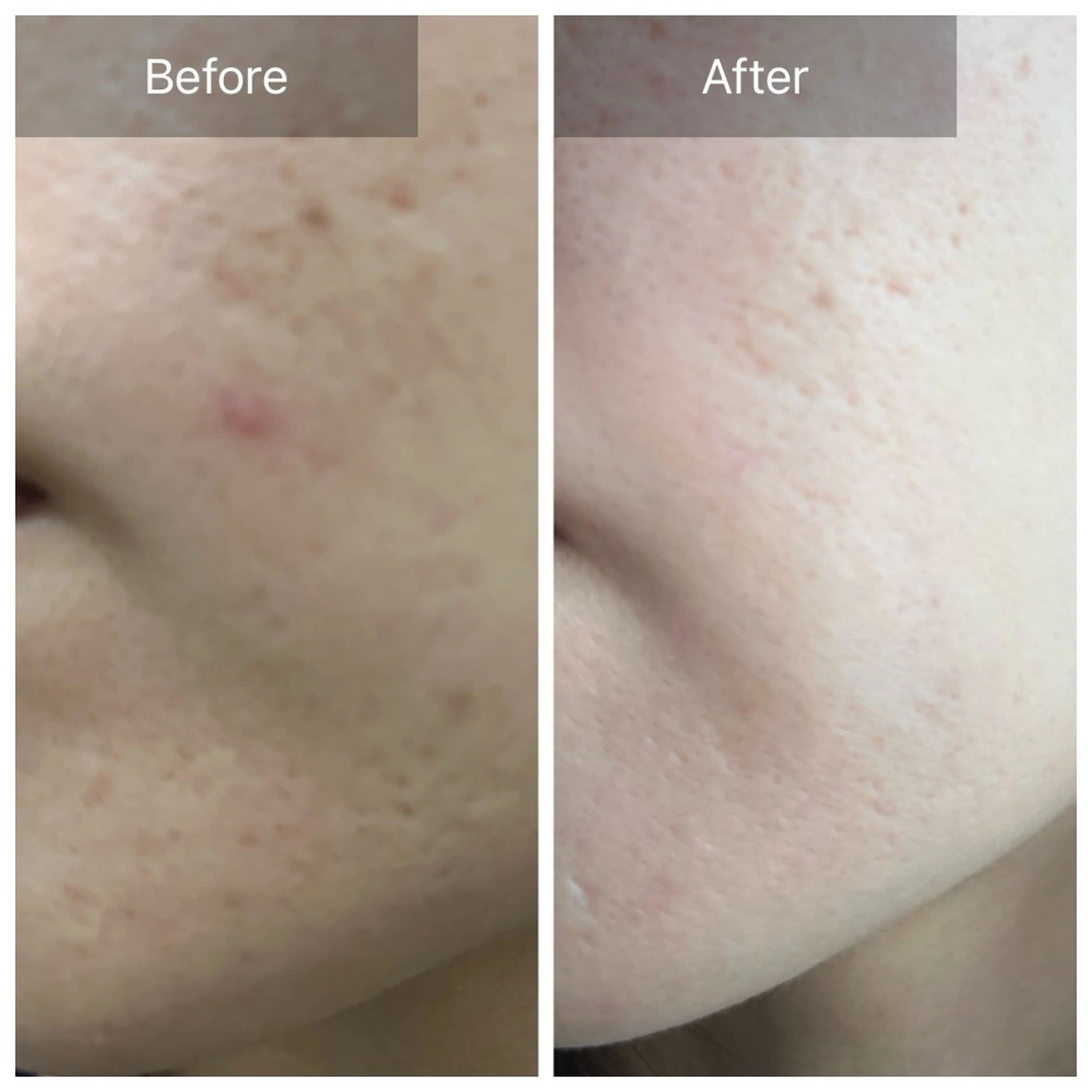 毛穴が見えなくなるサロン  Horo所属・岡 えり子のエステ・リラクイメージ