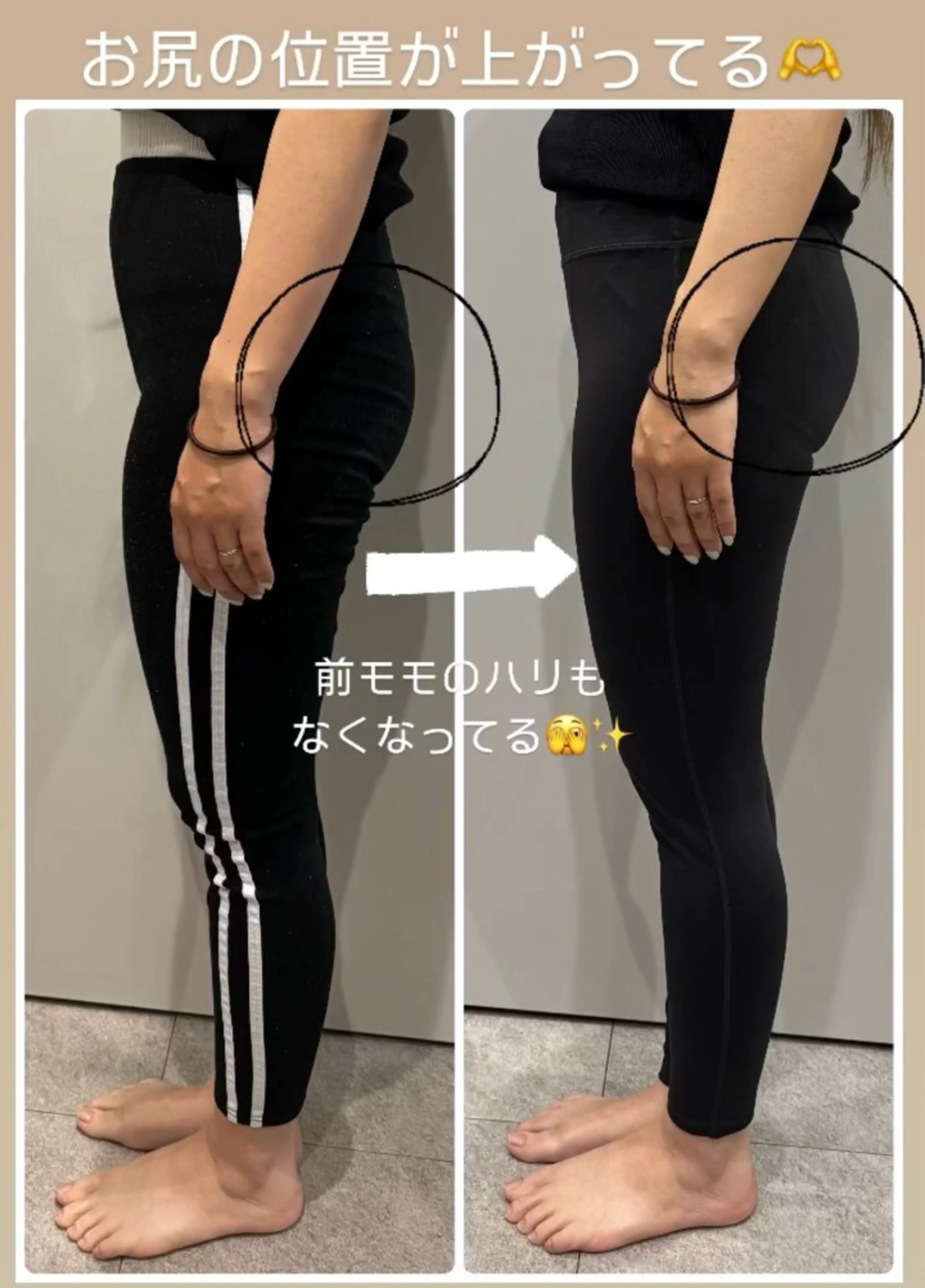 クラスペディア脱毛 ・フェイシャル専門店のエステ・リラクイメージ