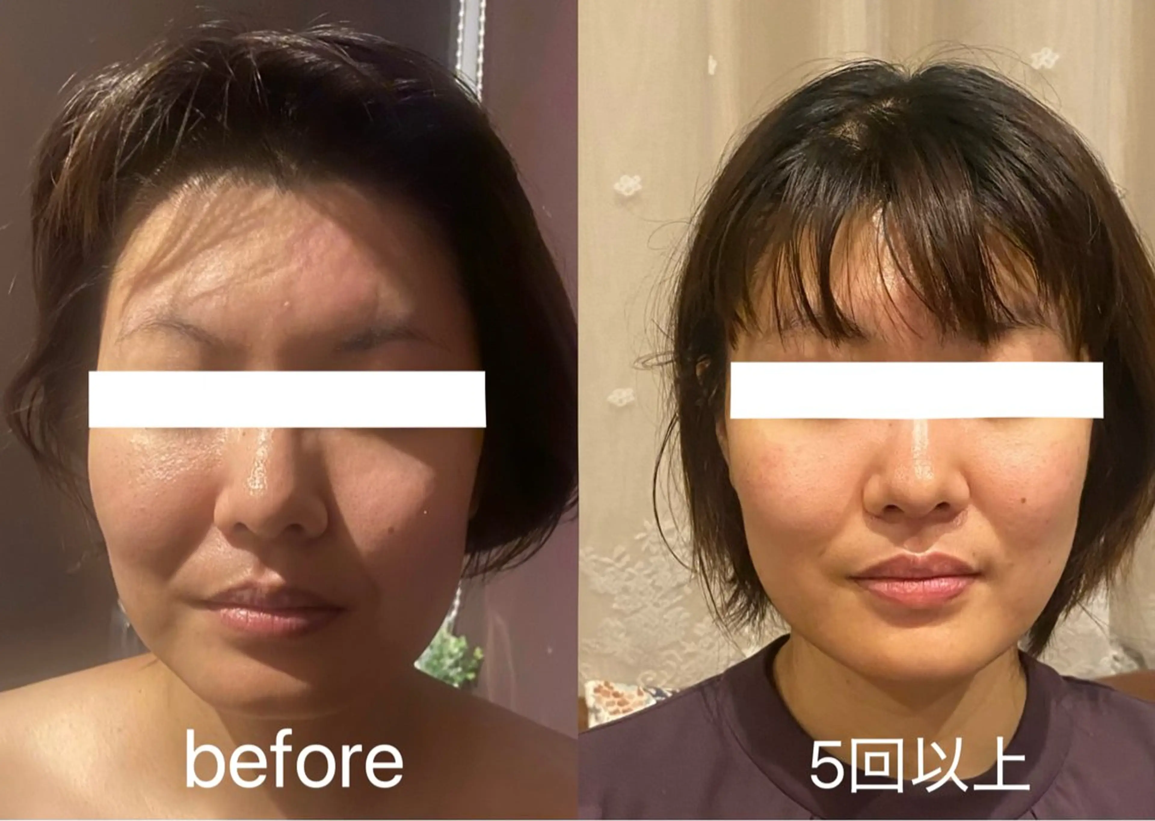 🧚‍♀️優来 リラク痩身肌質改善のエステ・リラクイメージ