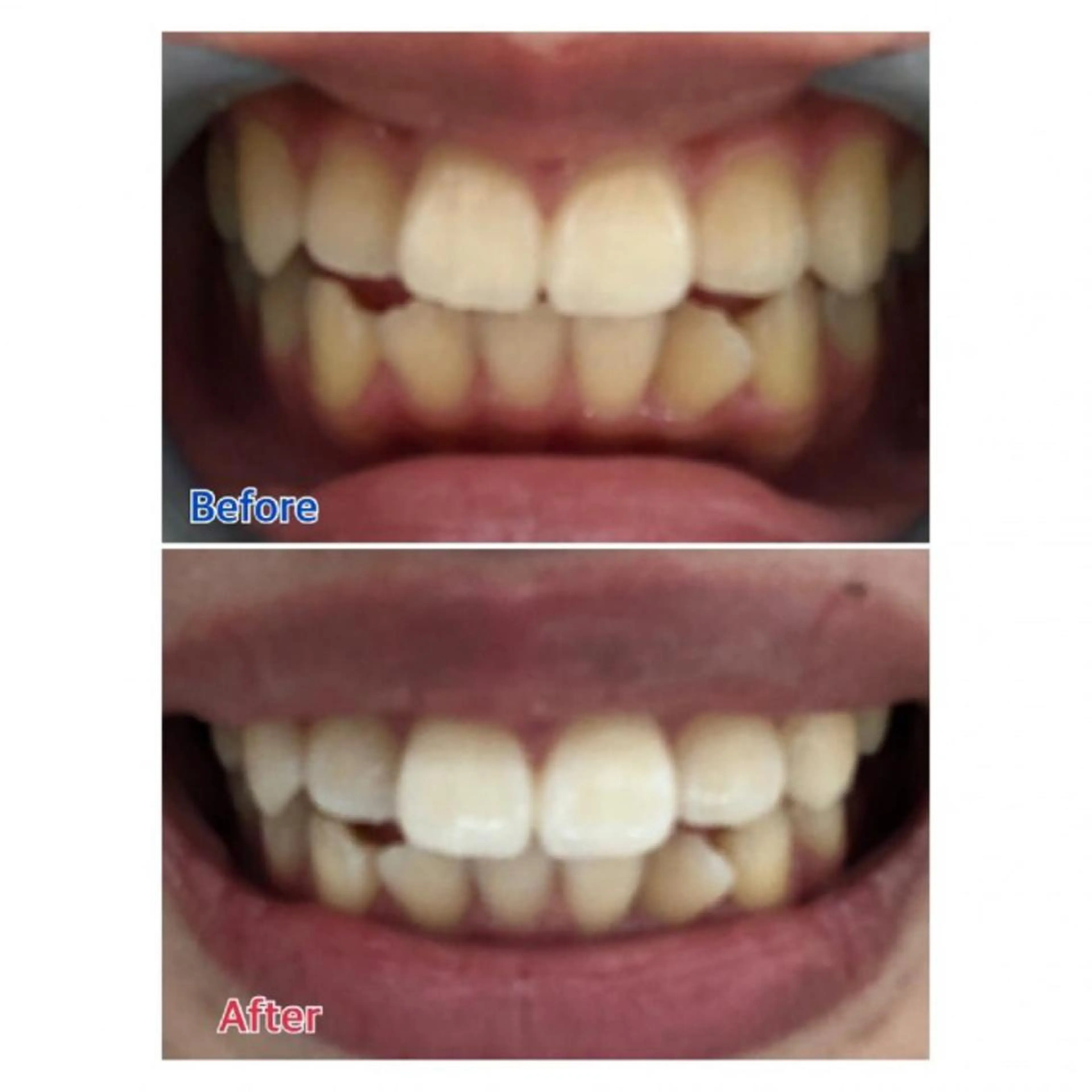 M渋谷店所属・Ｍ渋谷 ホワイトニングのエステ・リラクイメージ