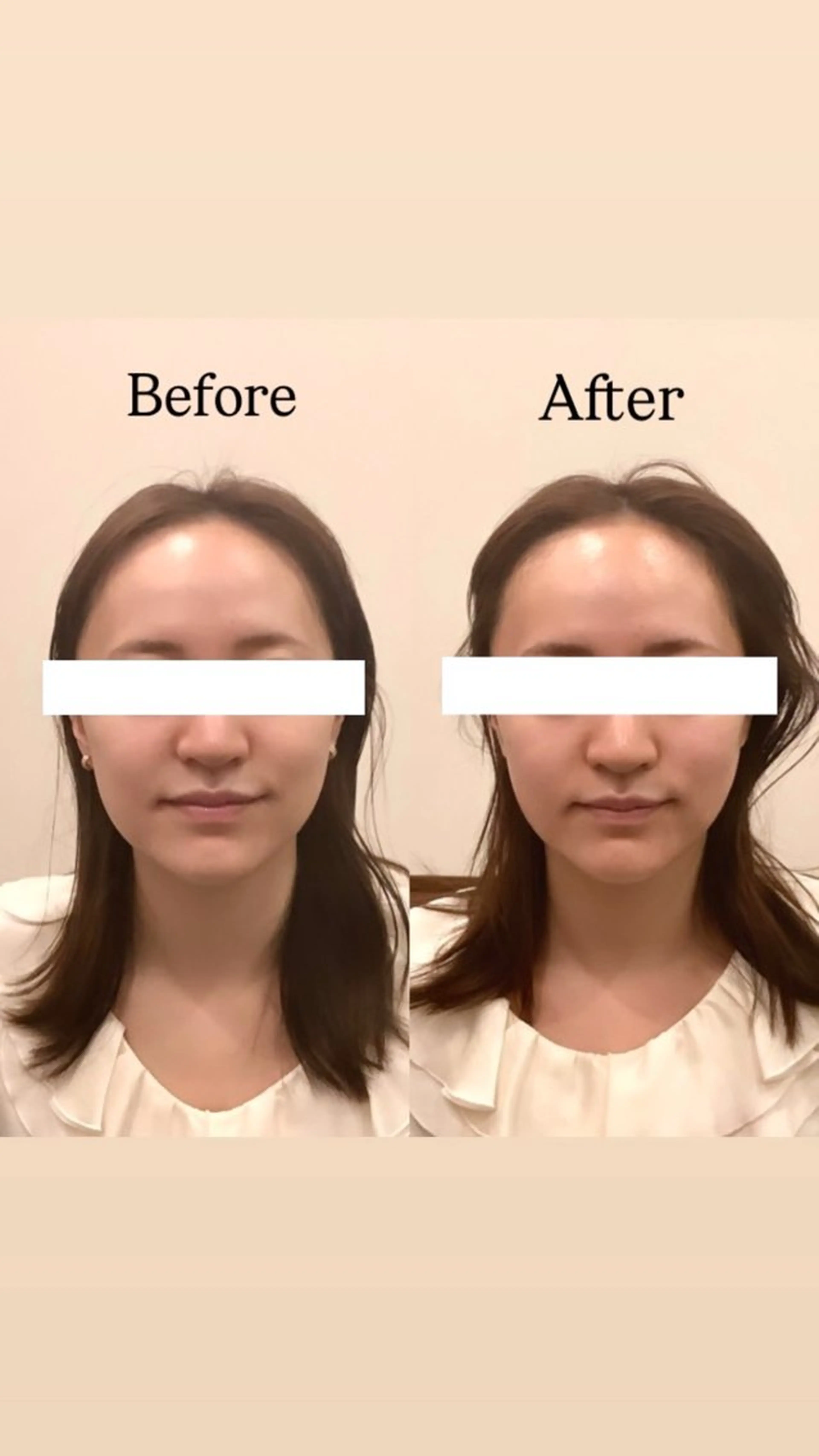 Hari Lounge恵比寿所属・chika🦋 ハリラウンジ恵比寿のエステ・リラクイメージ