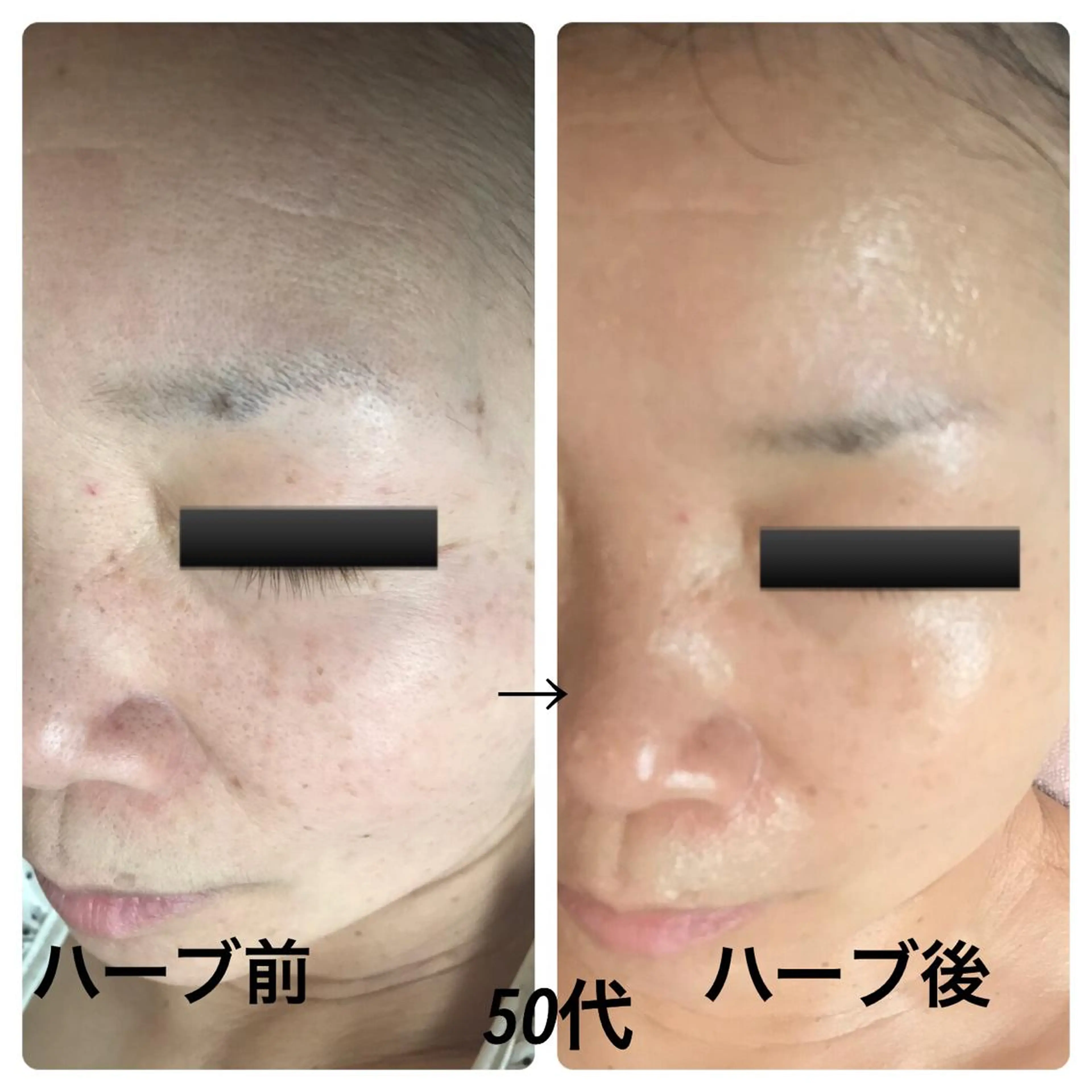 フェアリーローズ所属・fairyrose organicエステのエステ・リラクイメージ