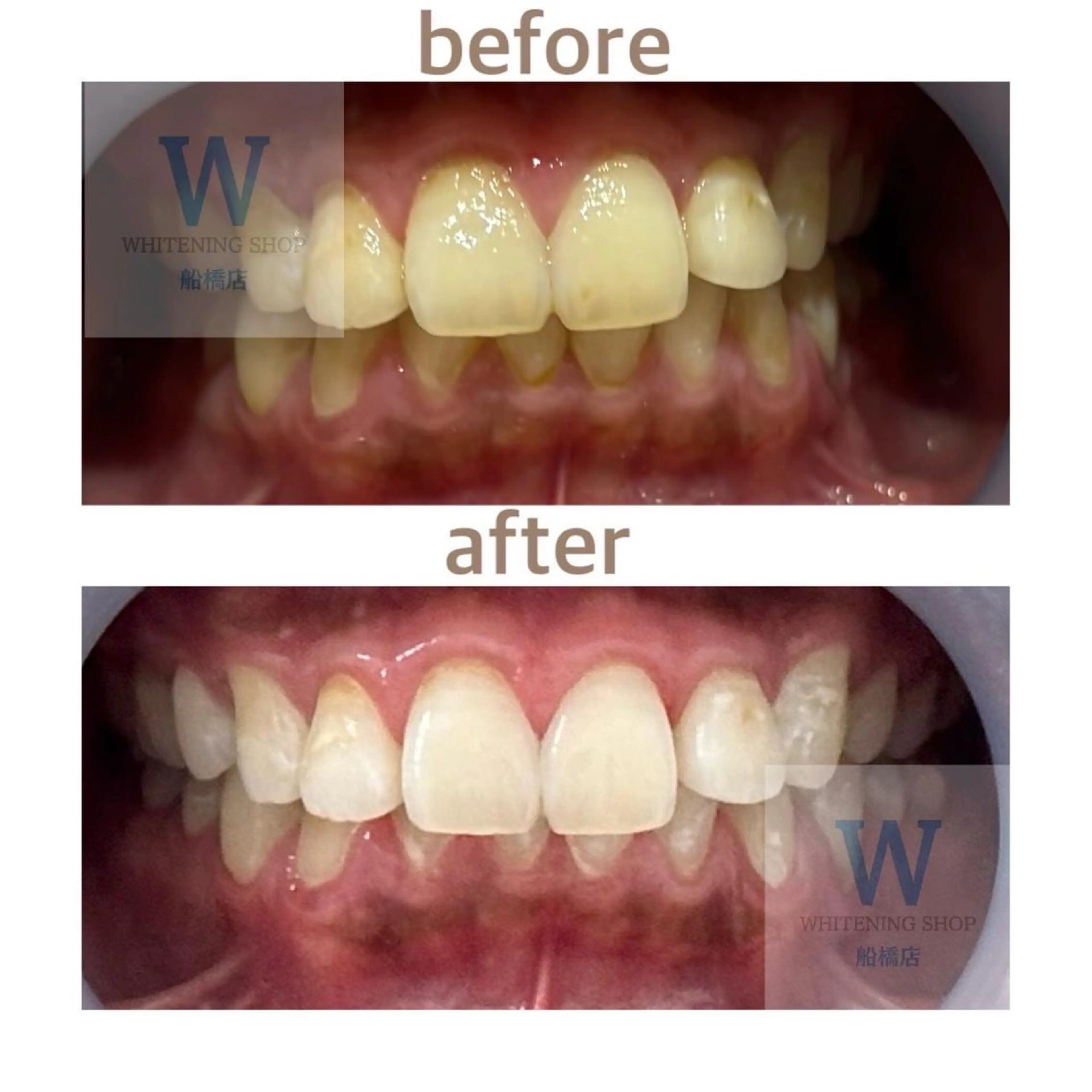 エステ リラク ホワイトニング ショップ船橋２号店のエステ・リラクイメージ