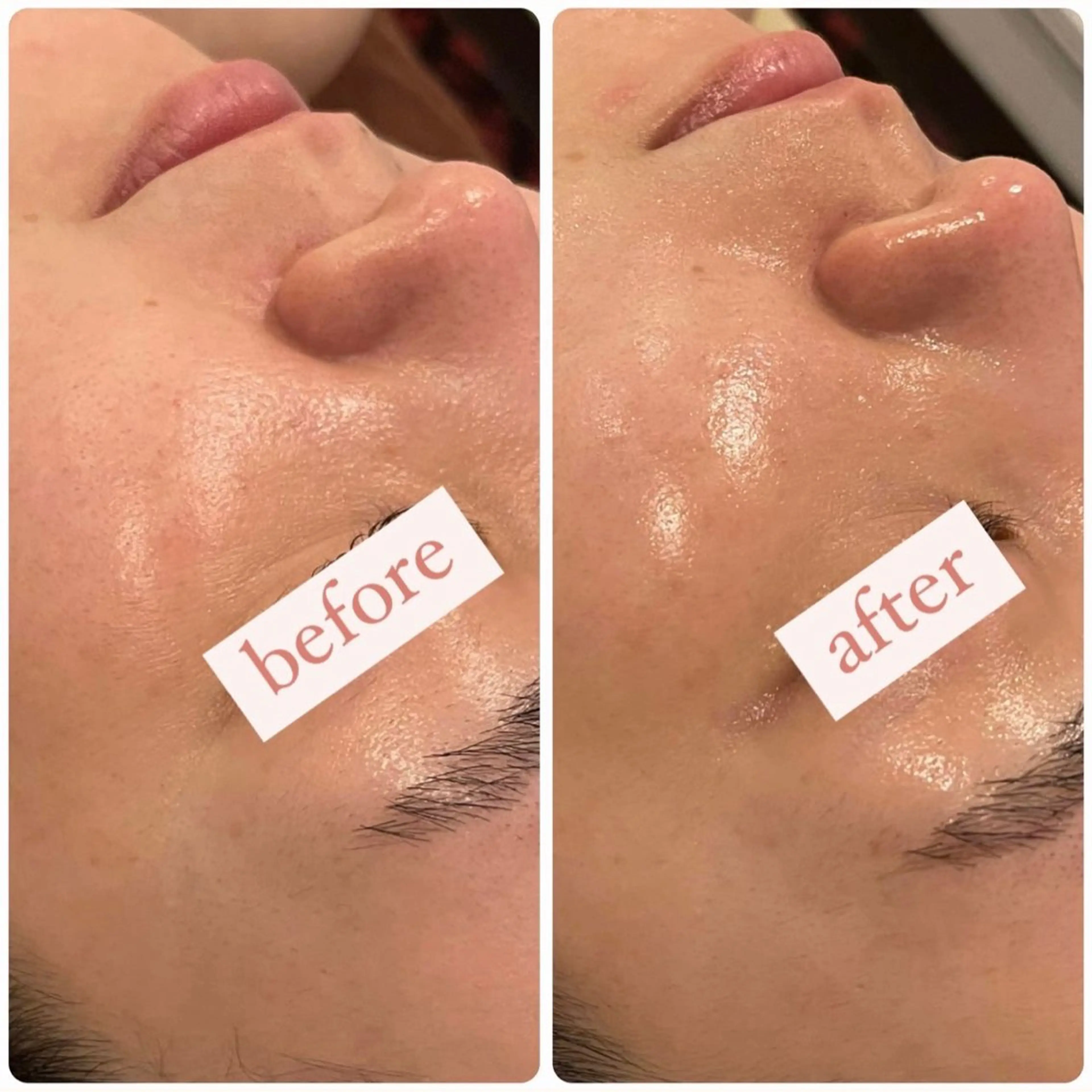 立体小顔×艶肌×美ボ ディ似合わせ施術 岡のエステ・リラクイメージ