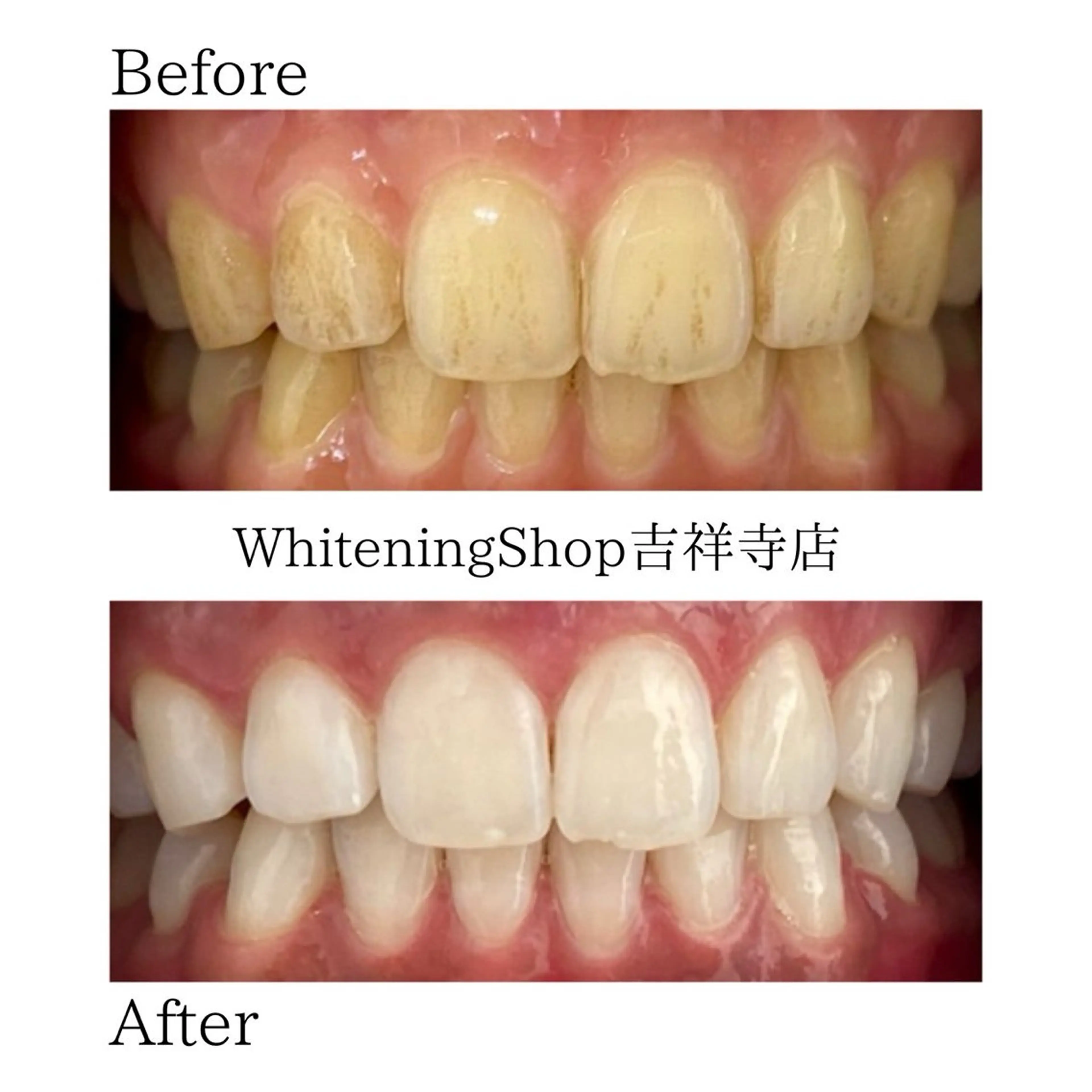 エステ リラク ホワイトニング ショップ吉祥寺店のエステ・リラクイメージ