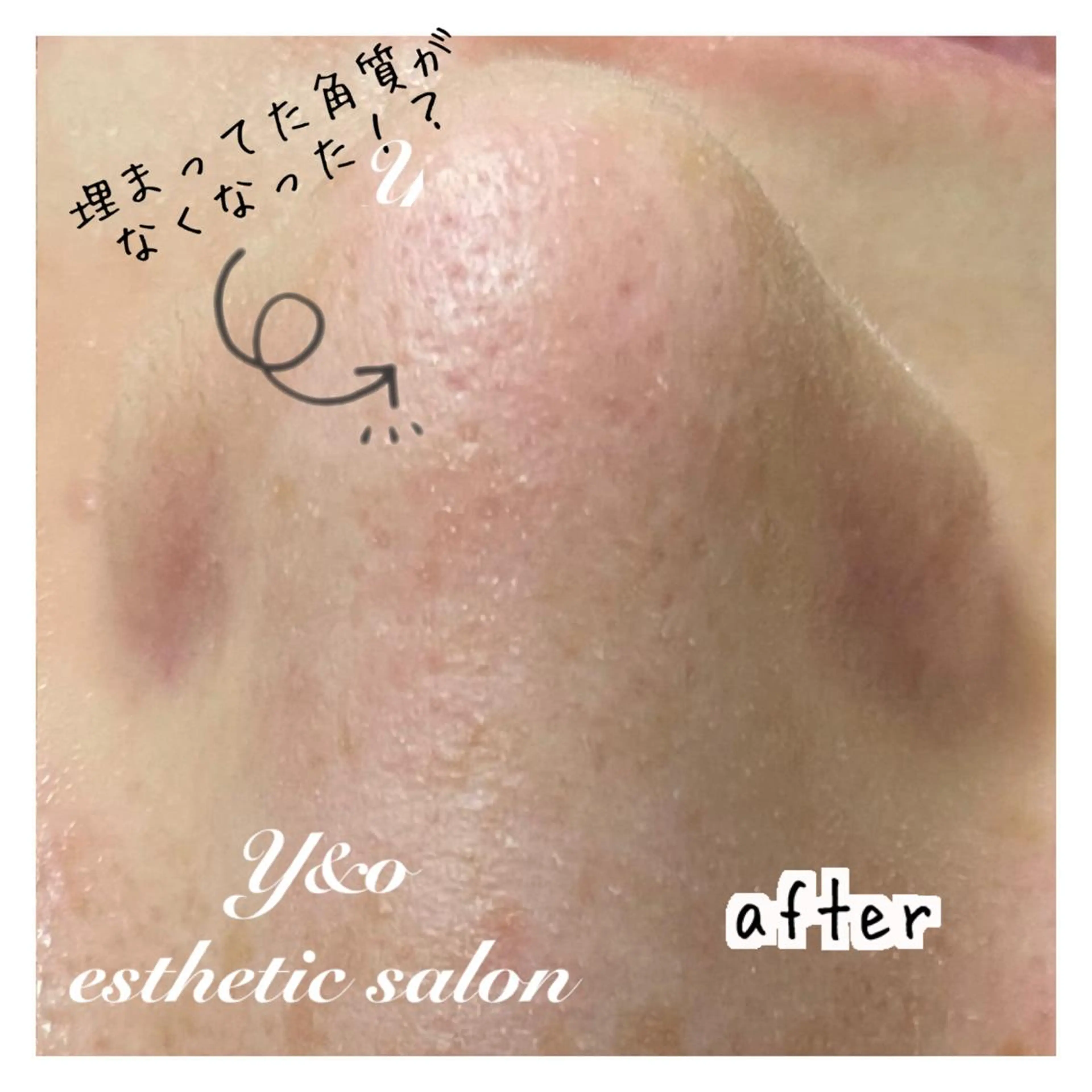 エステ 〜小顔・痩身・リラクゼーション〜　　Y&o Esthetic  Salon所属・HANA MIKIの眉毛・アイブロウイメージ
