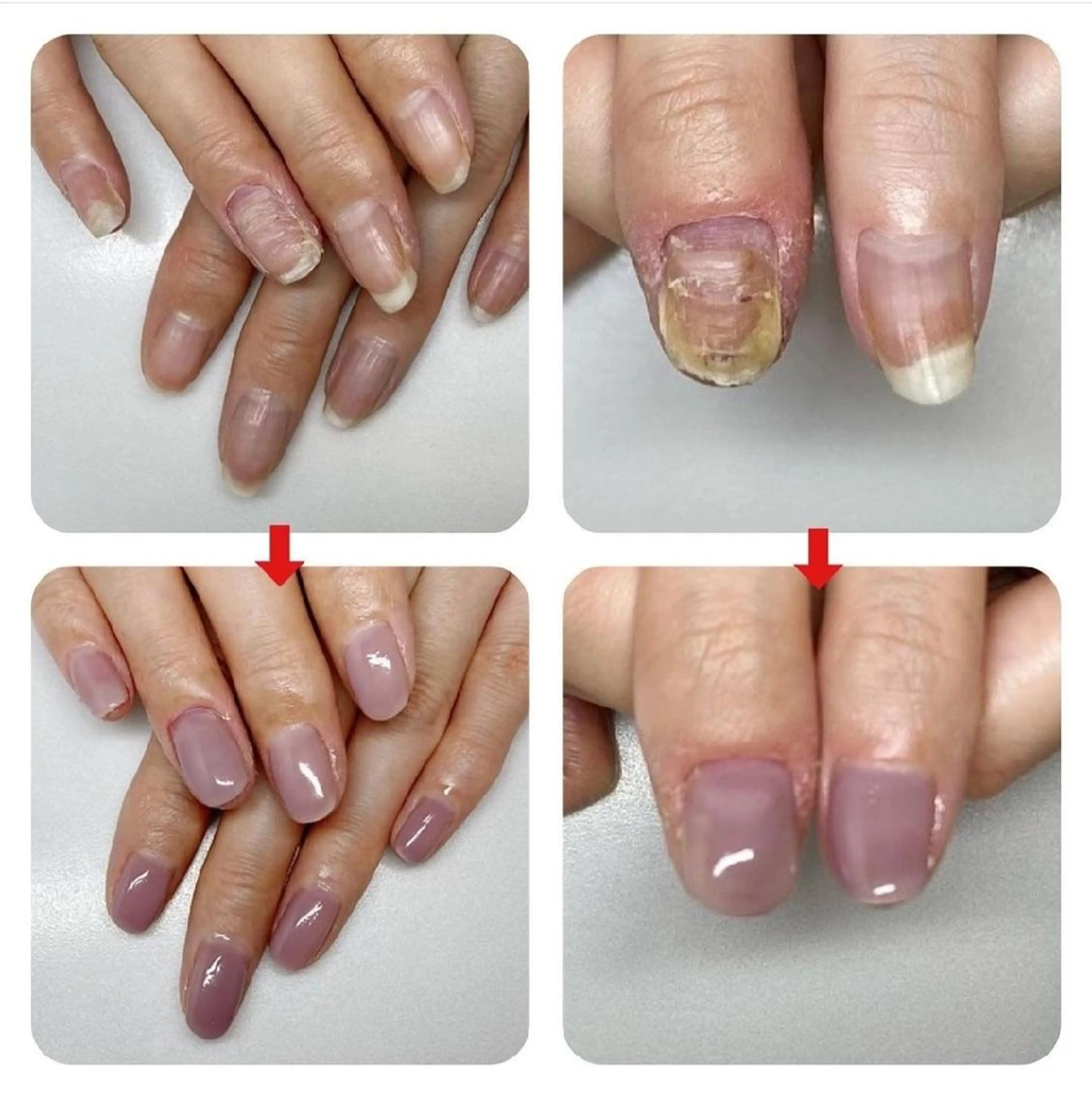 ネイル ネイルサロンアリューム所属・ネイルサロン アリュームのネイルデザイン