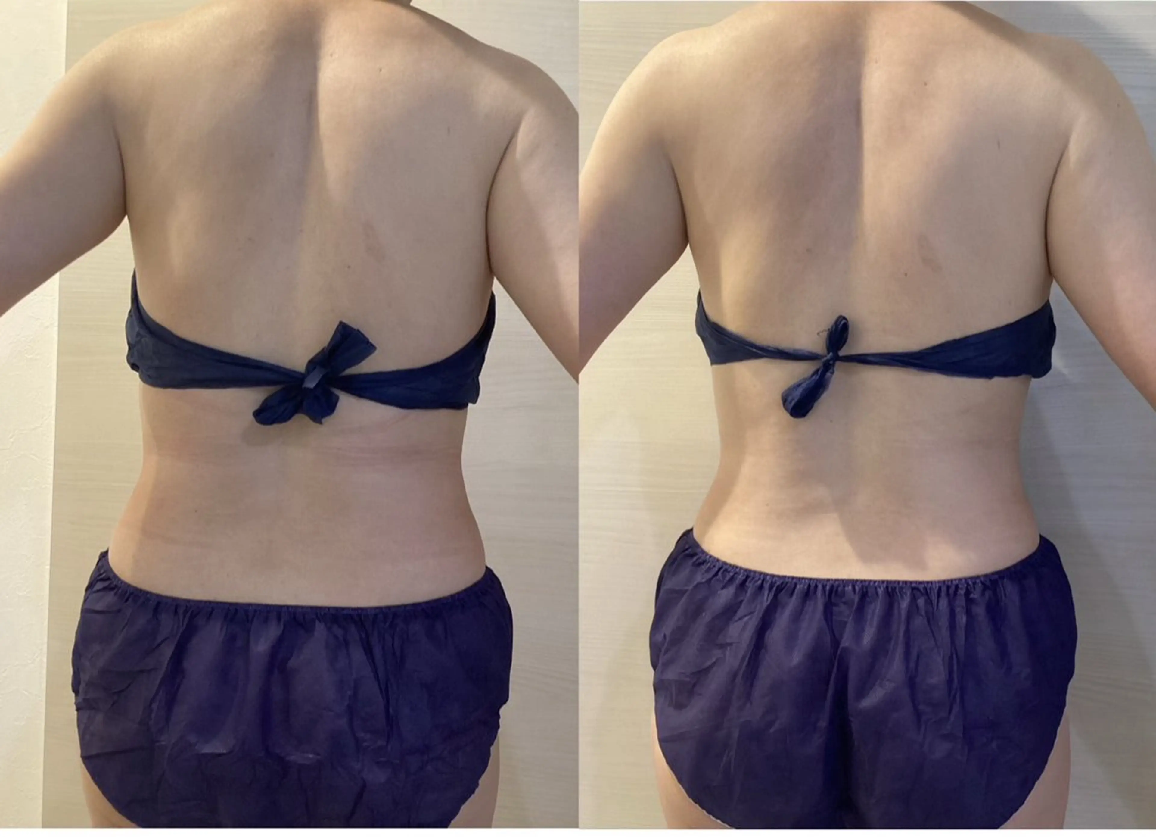 エステ リラク ホワイティアビシェル ウラワ　白澤奇のその他イメージ