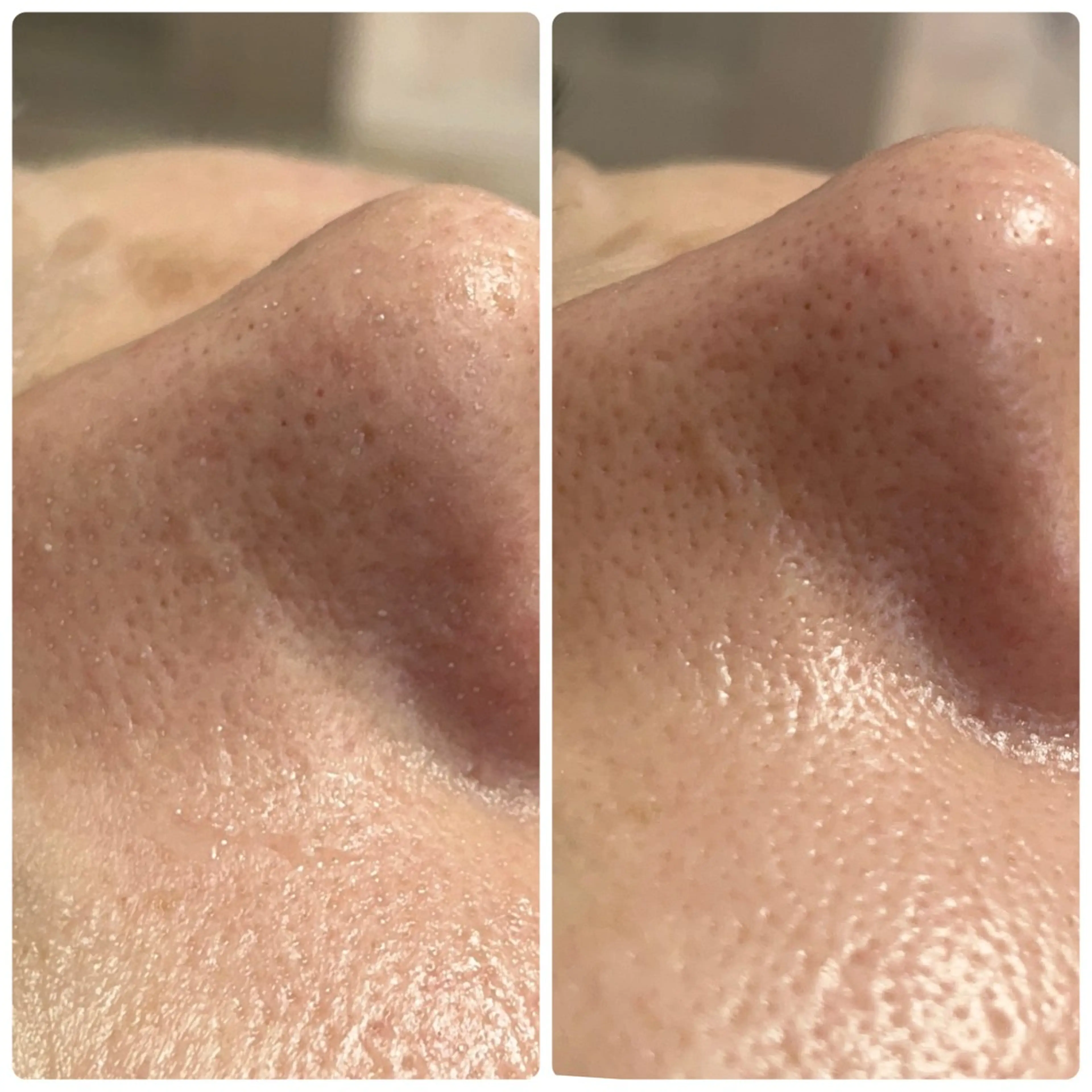 エステ beautysalon LINO所属・平日昼間限定★ 全メニュ¥6600のエステ・リラクイメージ